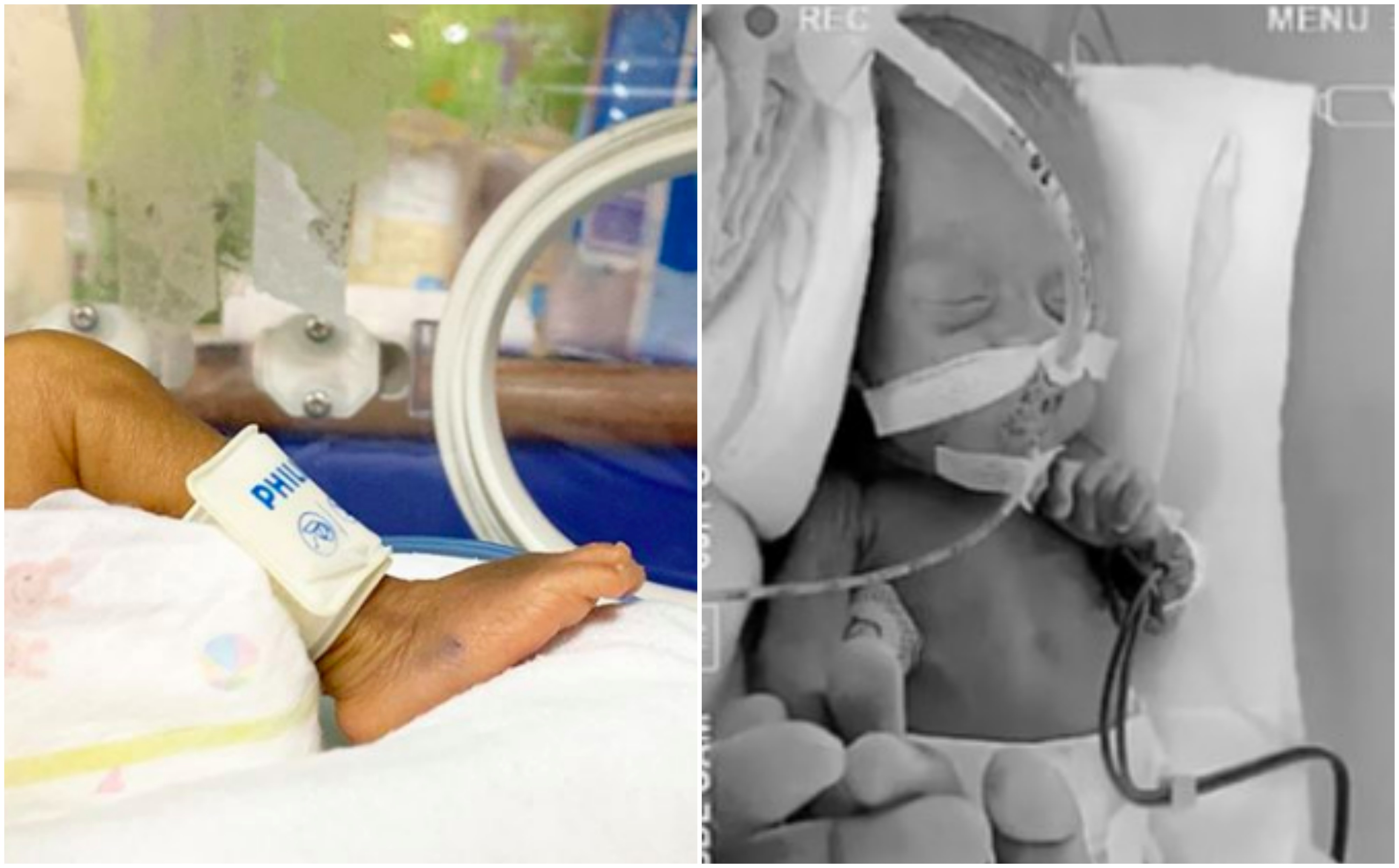 ‘Allah Pinjamkan Baby D Sekejap Je..’ – Bayi Pramatang Abby Abadi Dijemput Ilahi