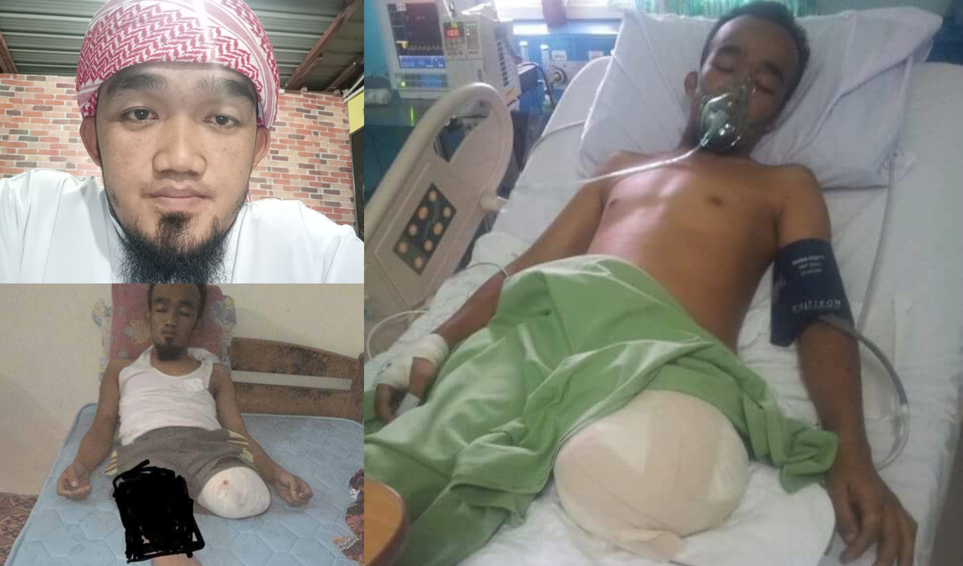 ‘Niat Nak Tolong Tapi..’ – Lelaki Kongsi Derita Selepas Dilanggar Lori 3 Tan