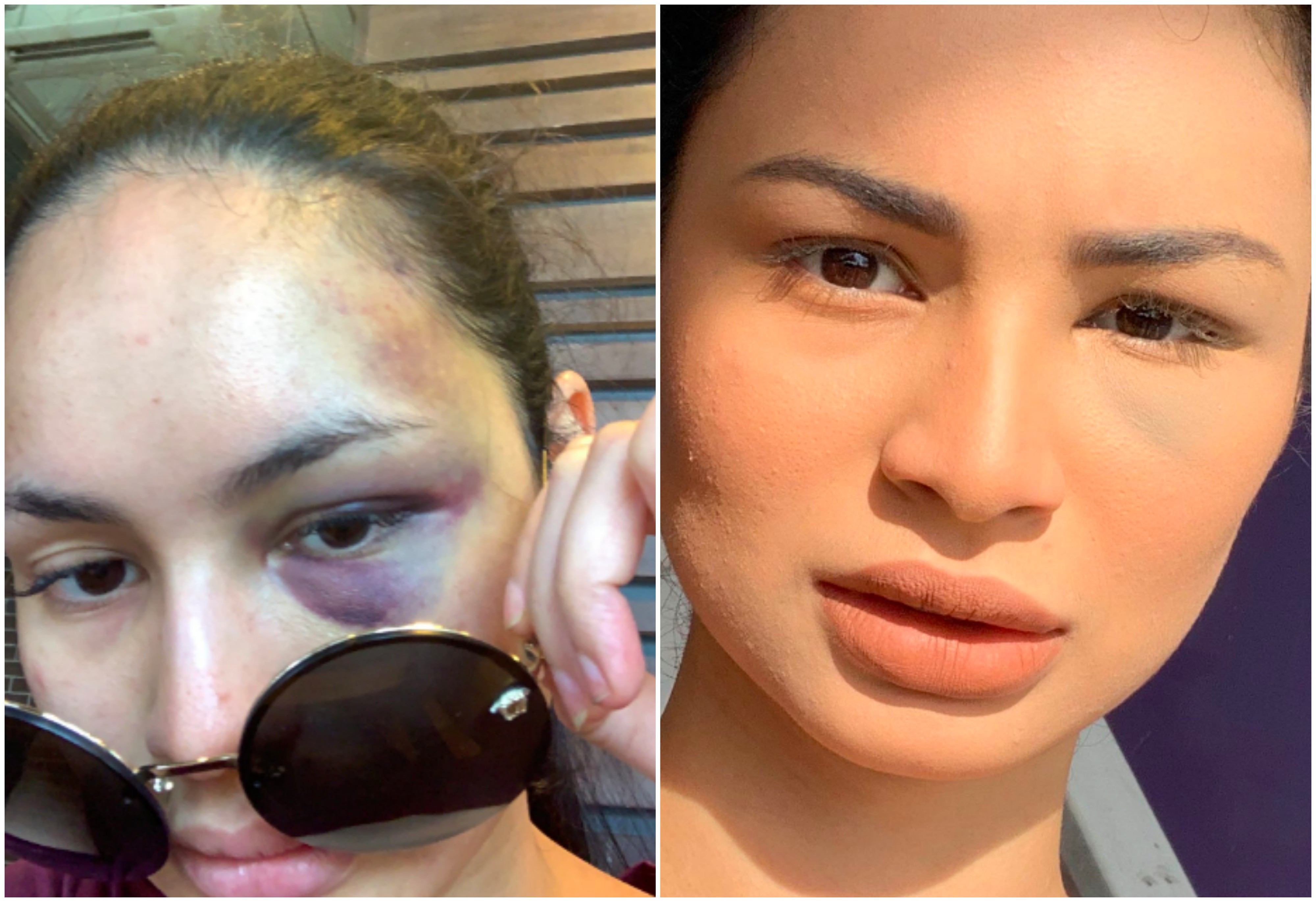 ‘You Mati Baru Diorang Stop Shooting’ – Izara Aishah Dedah Sisi Gelap Dunia Hiburan
