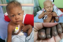 Anak Hidap Sakit ‘Tumor Wilms’, Ibu Mohon Bantuan Kewangan Bayar Kos Rawatan