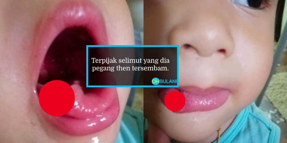 Detik Cemas Lidah Anak Terkoyak Semasa Jatuh Tersembam Di Lantai Rumah