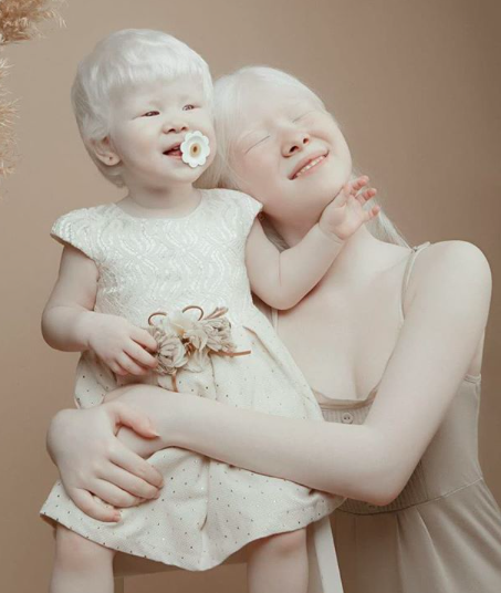 Empat beradik albino