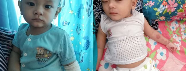 'Pada Mulanya Naik Macam Kena Gigit Nyamuk' – Derita Bayi 