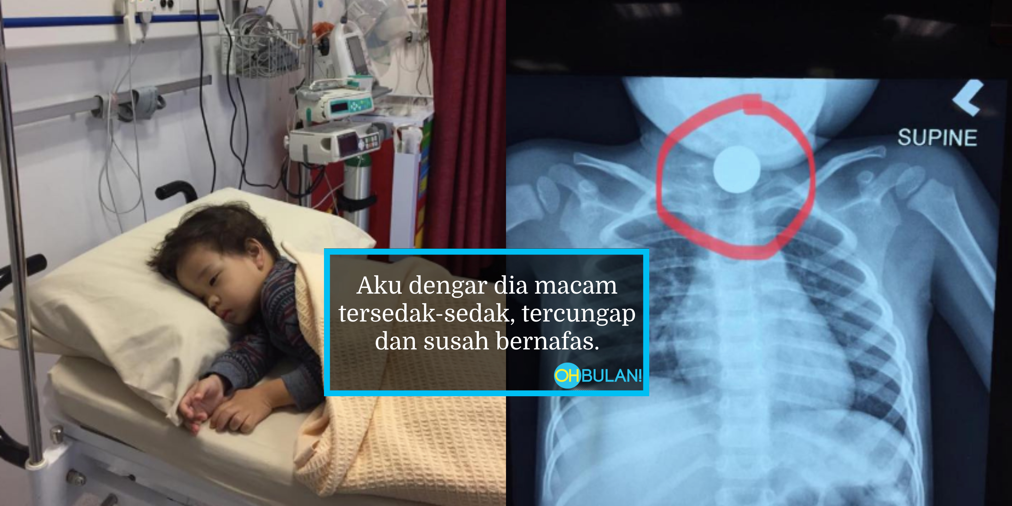 Detik Cemas Anak Tertelan Duit Syiling 20 Sen, Dipercayai Tercicir Dari Poket Suami