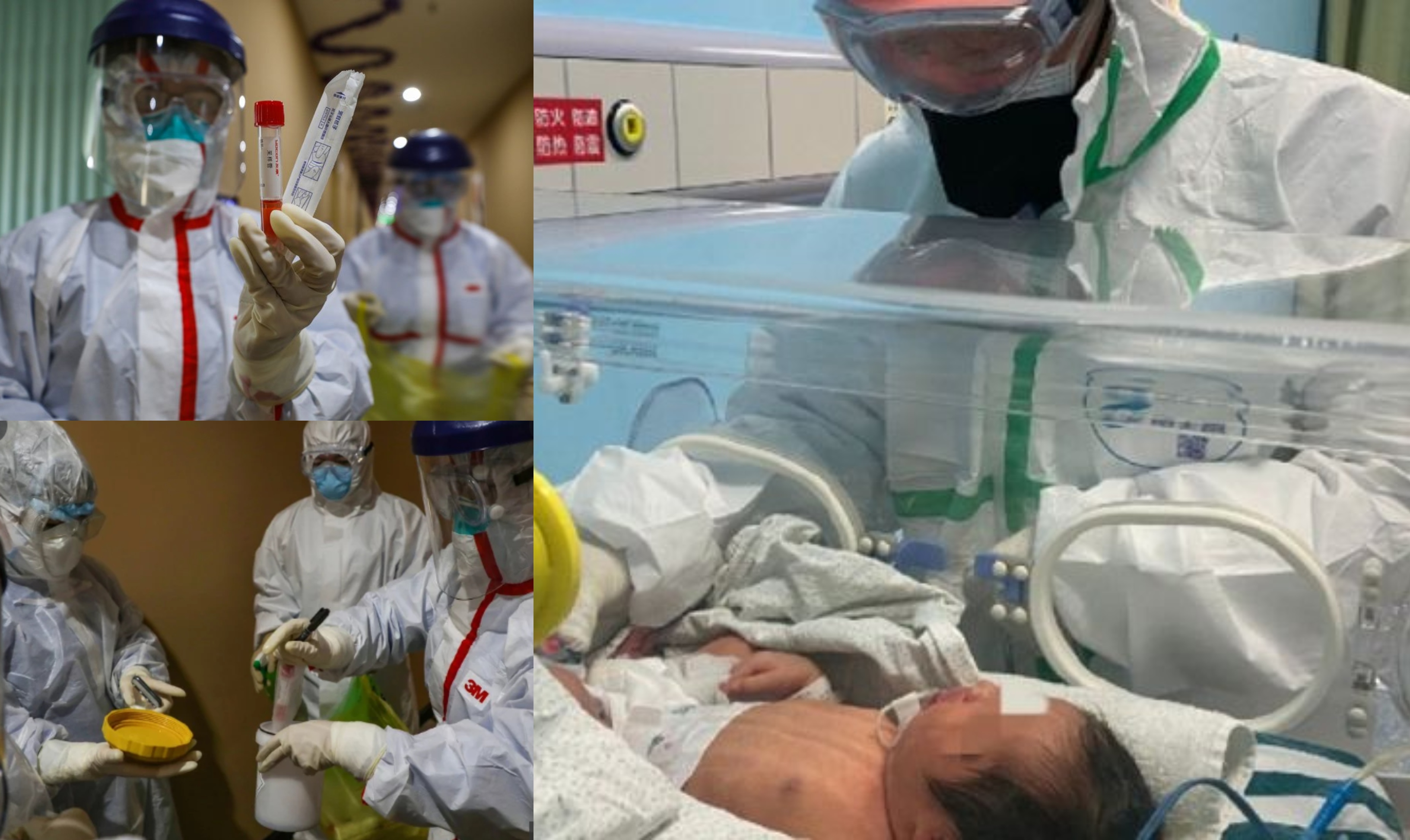 Baru 30 Jam Dilahirkan, Bayi Disahkan Positif Coronavirus