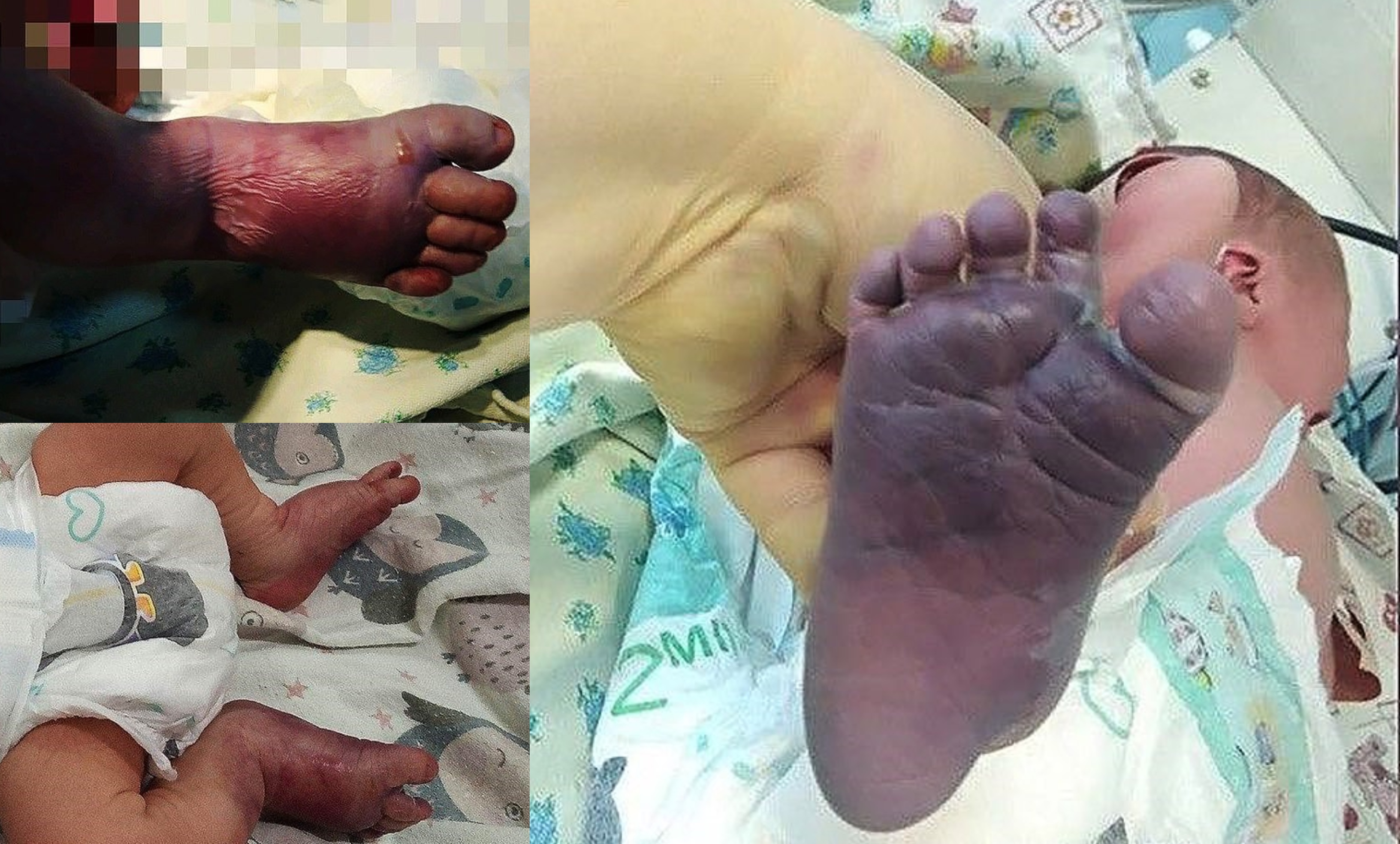 Padah Guna Khidmat ‘Bidan Palsu’, Bayi Baru Lahir Alami Patah Tulang Kaki & Kekurangan Oksigen