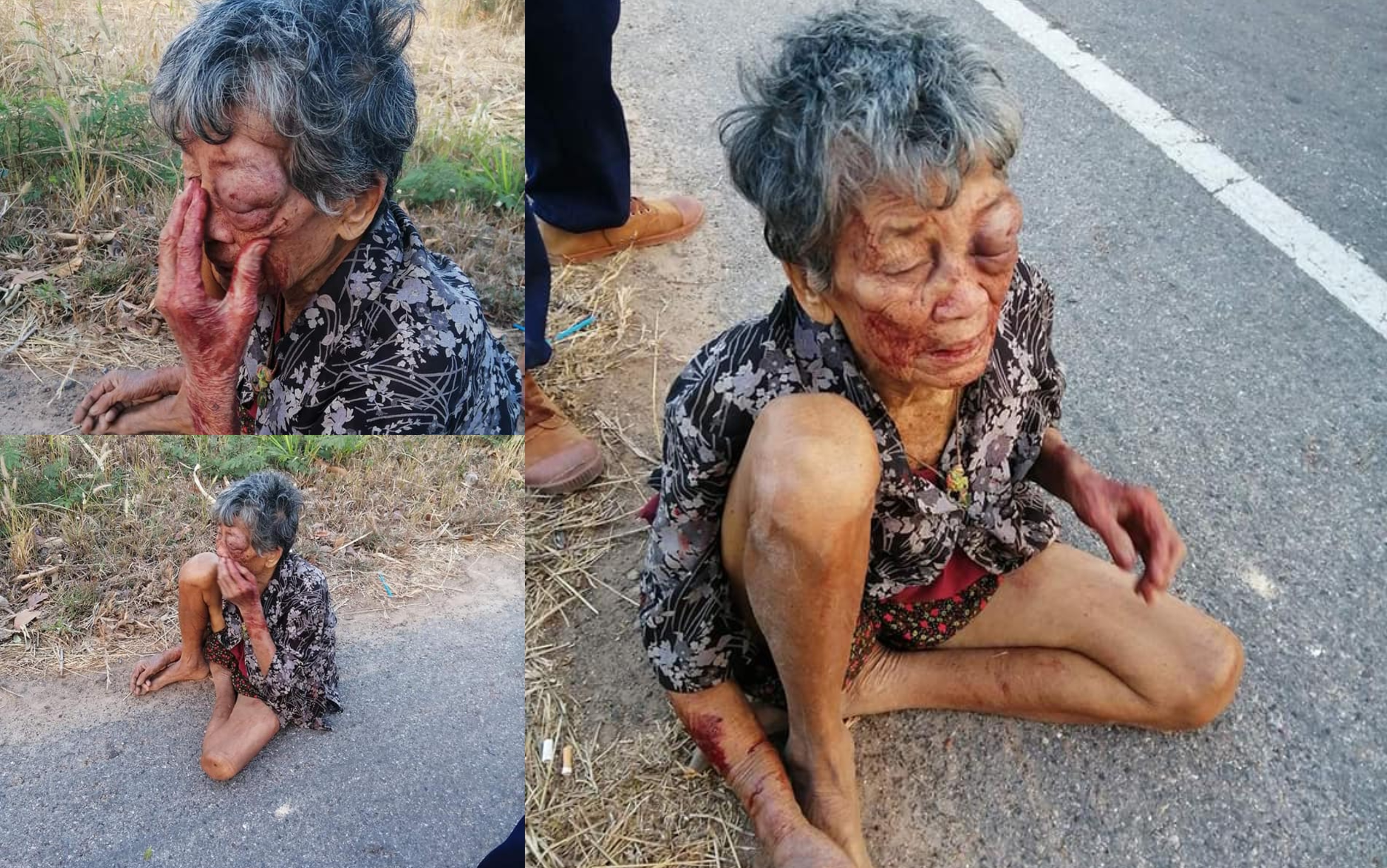 Nenek Uzur Terpaksa Lari Daripada Rumah & ‘Tersadai’ Tepi Jalan Selepas Dibelasah Teruk Cucu Mabuk