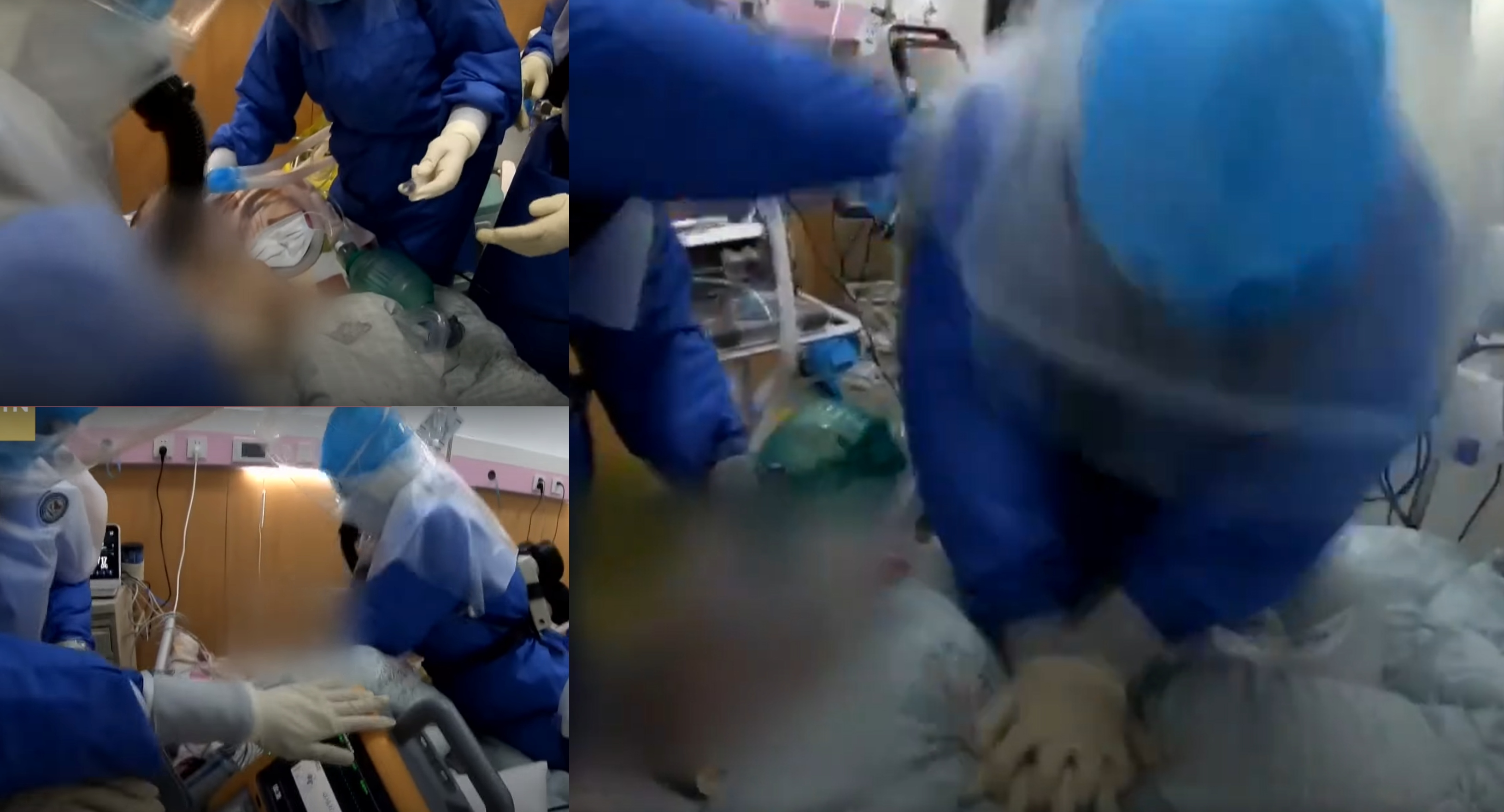 [VIDEO] Detik Cemas Doktor Selamatkan Pesakit Covid-19 Bikin Netizen Sebak