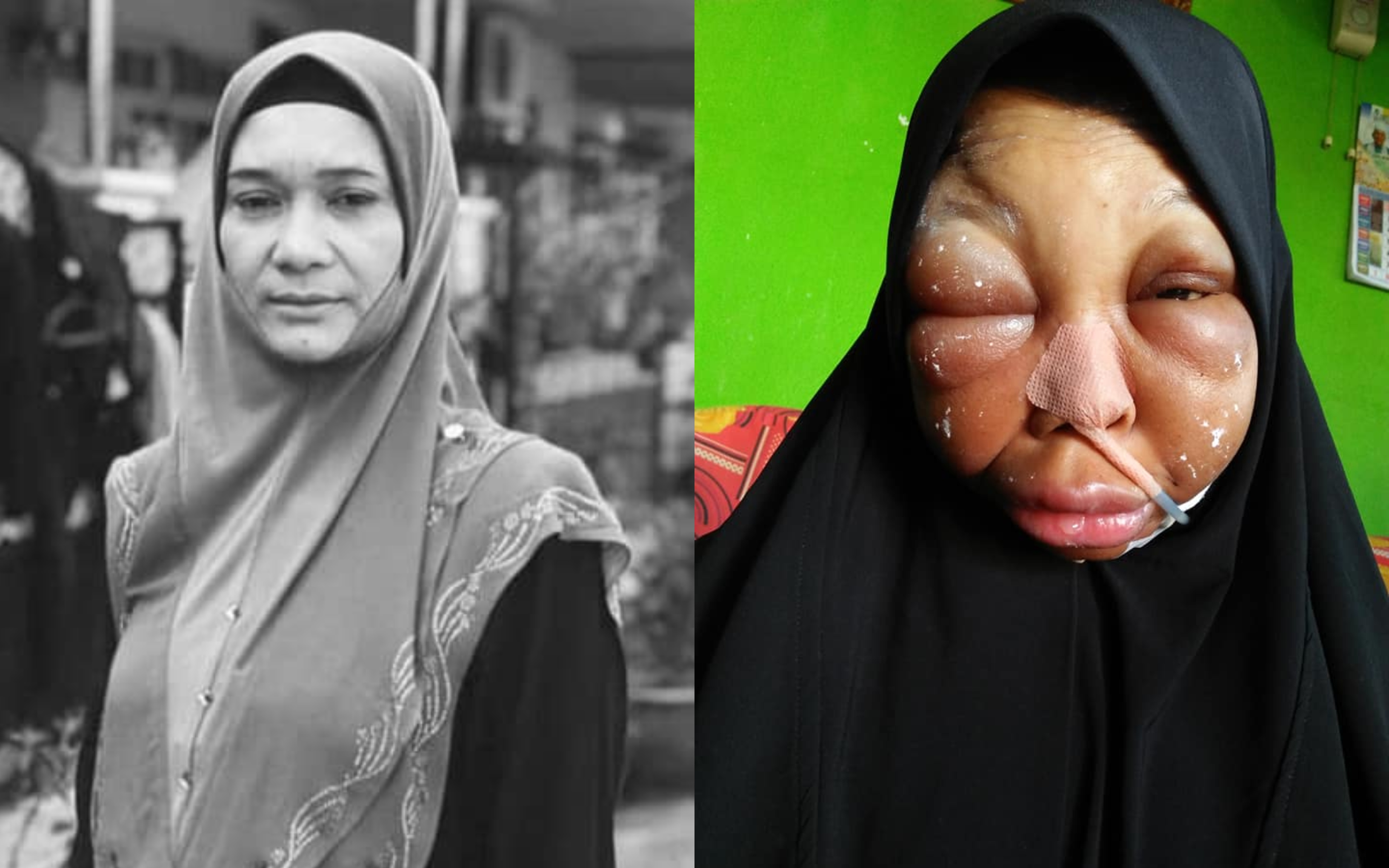 Sempat Tulis Nota Terakhir Buat Anak-Anak, Wanita Penghidap Kanser Lidah ‘Pergi’ Di Hari Jumaat