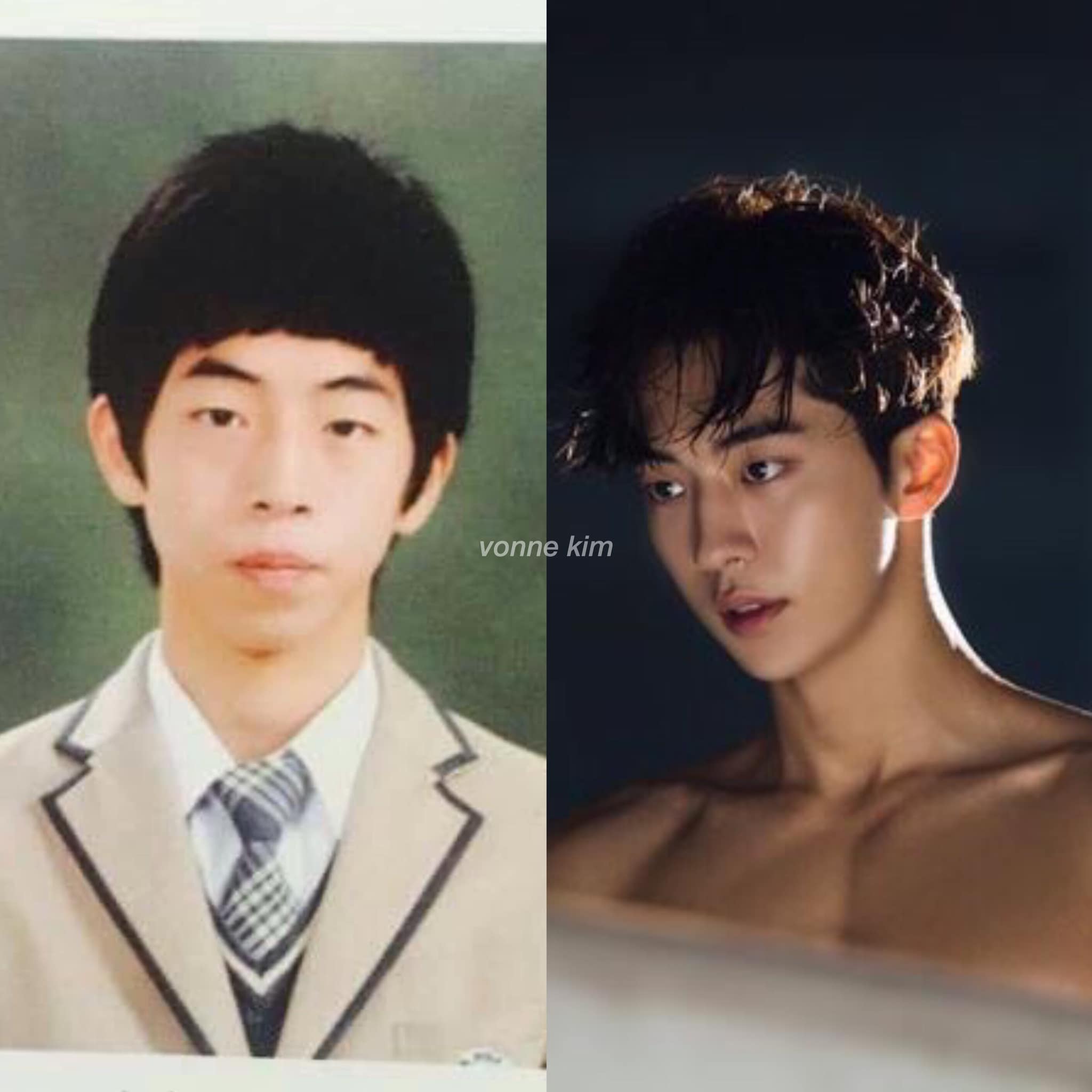 Nam joo hyuk plastic surgery