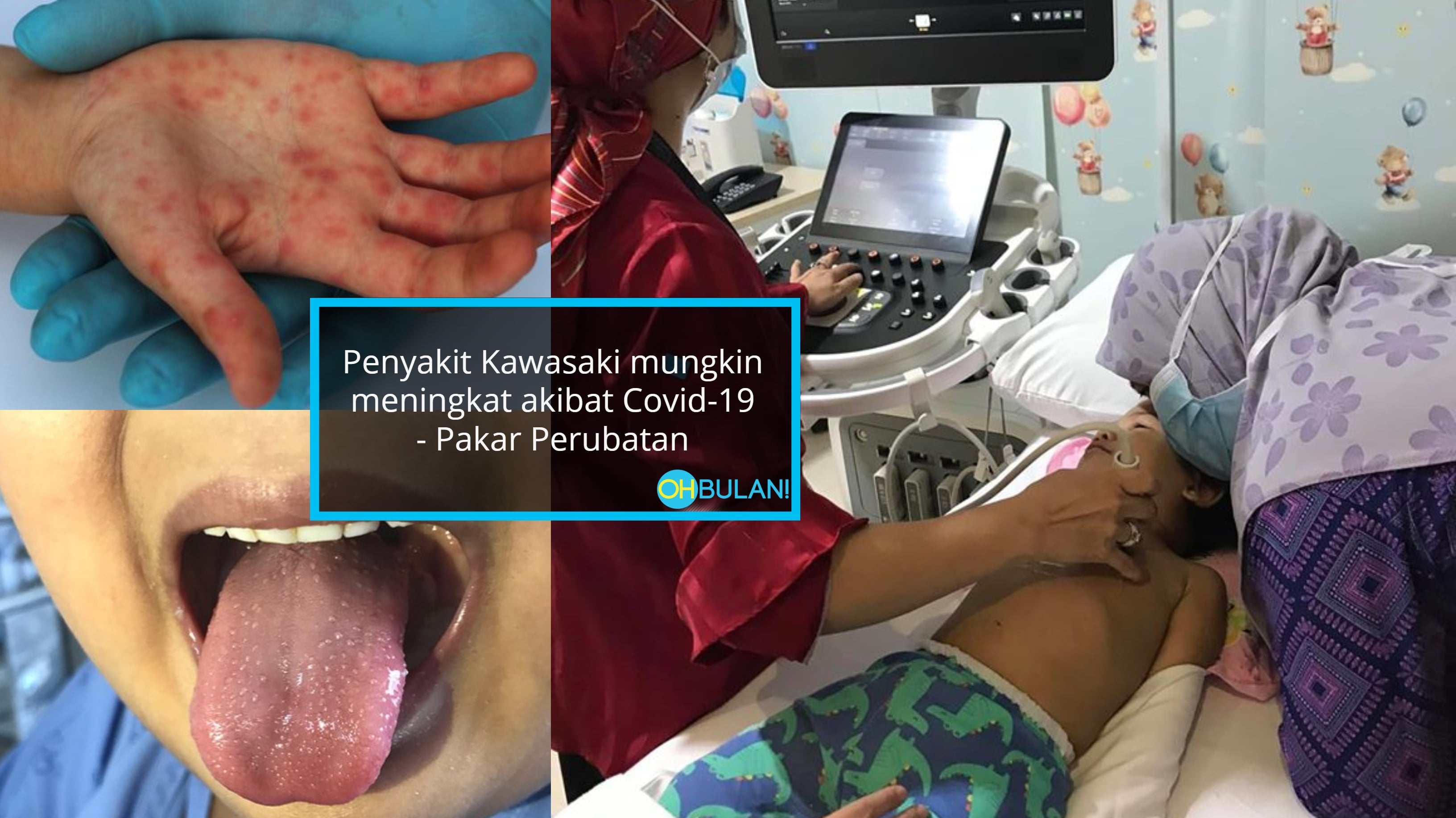 ‘Awalnya Doktor Kata Itu Adalah Demam Viral’- Ibu Terkejut Anak Hidap Penyakit ‘Kawasaki’