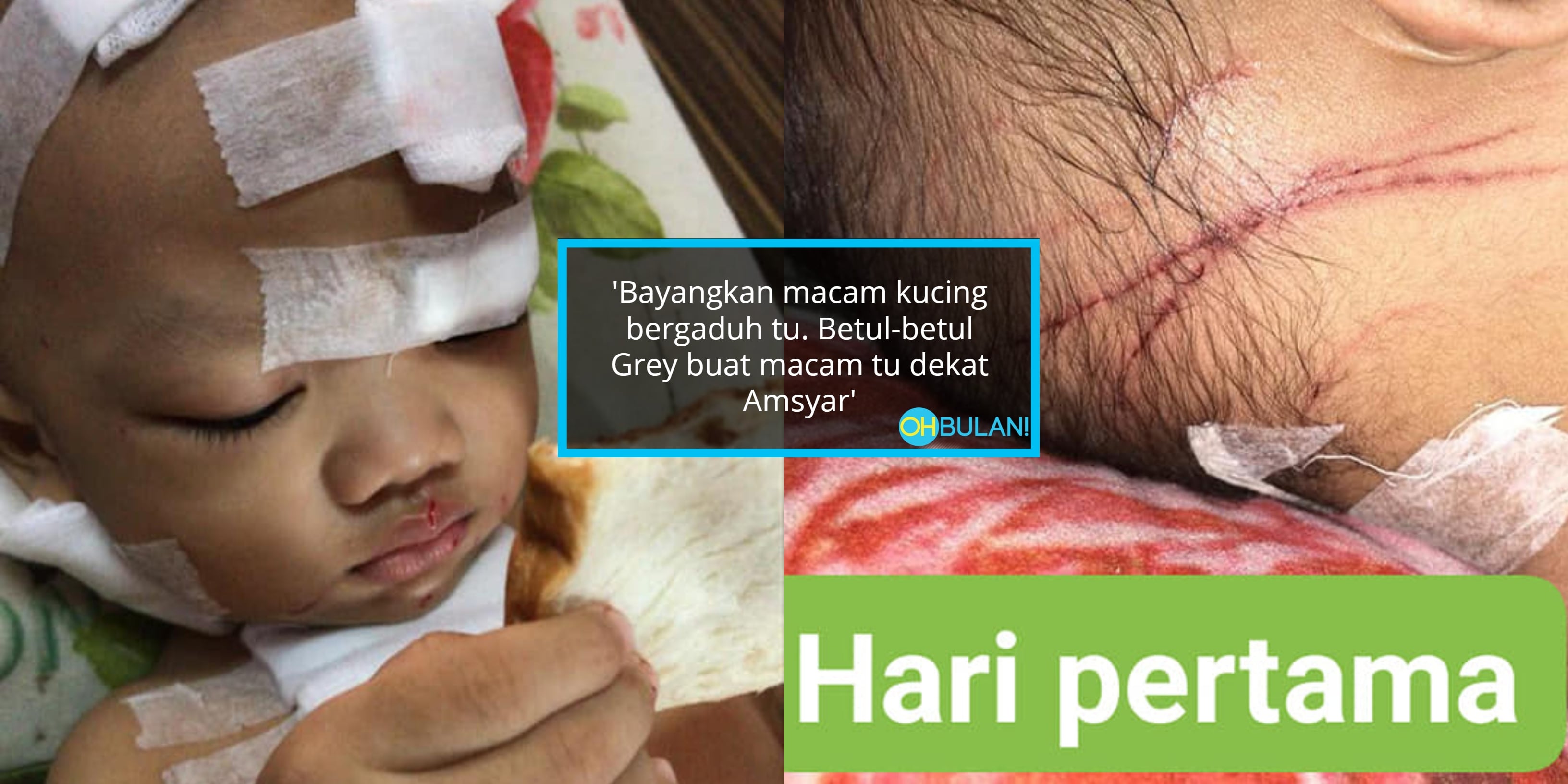 Kucing Tiba-Tiba ‘Naik Angin’ Serang Anak…