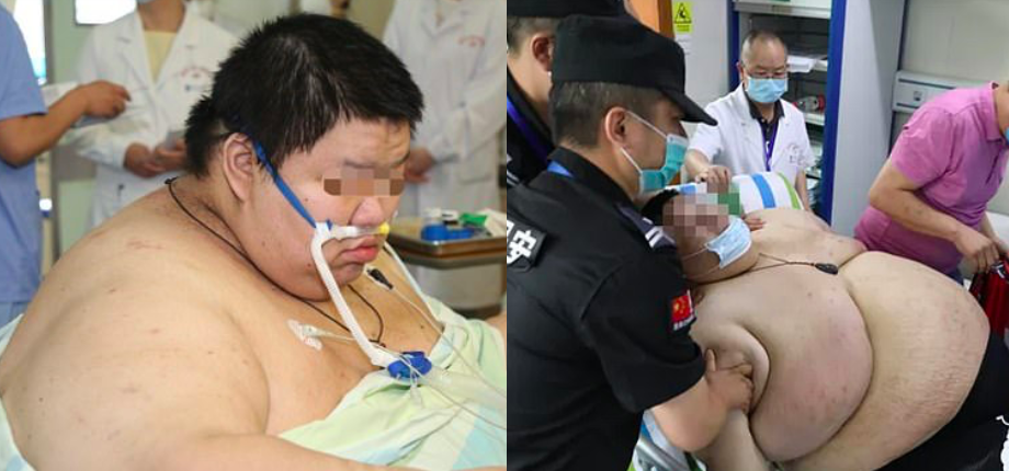 Berat Cecah 280KG Semasa Perintah Berkurung, Lelaki Ini Diisytiharkan Paling Gemuk Di Wuhan