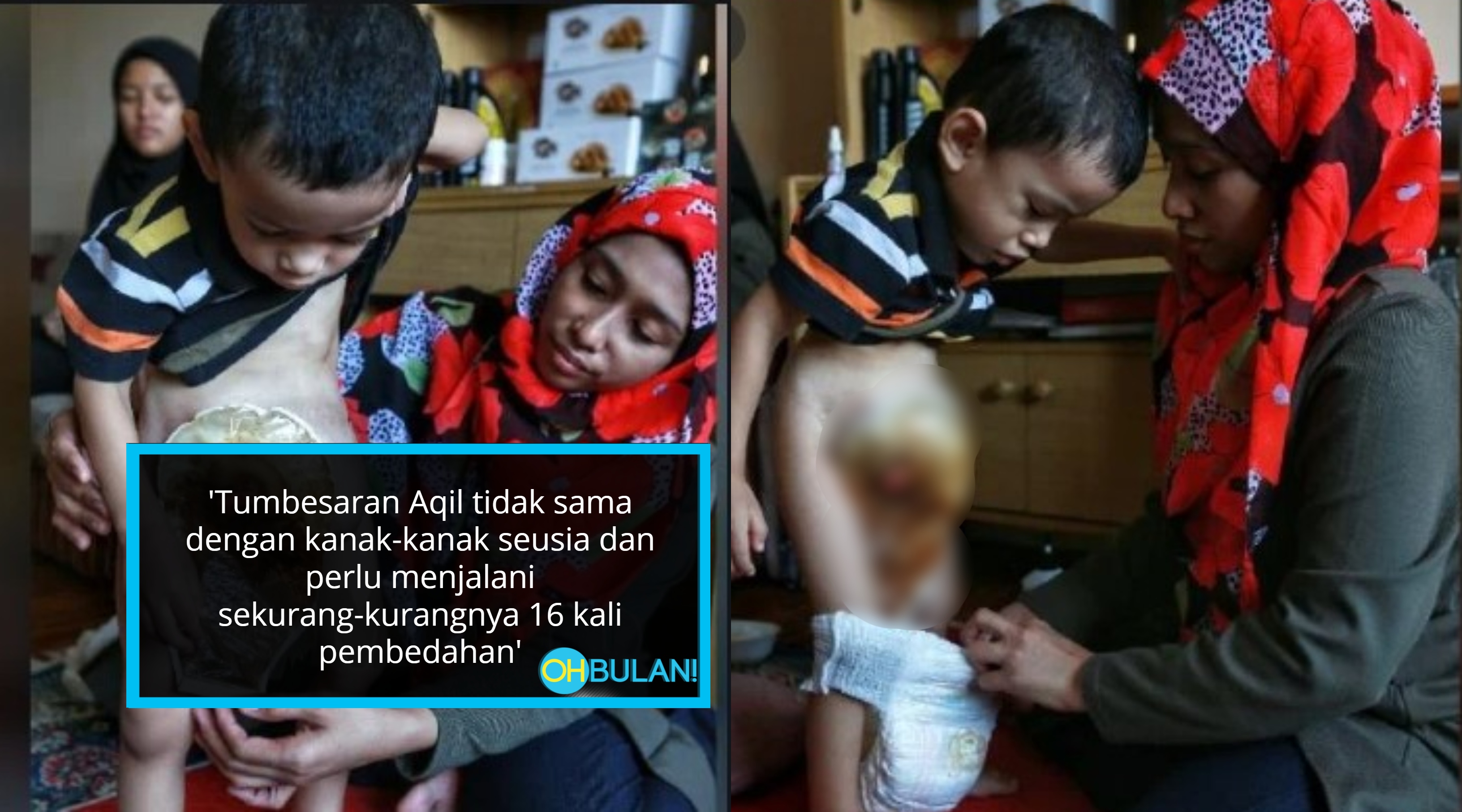 Dilahirkan Tanpa Dubur, Perjalanan Hidup Adik Aqil Meruntun Hati