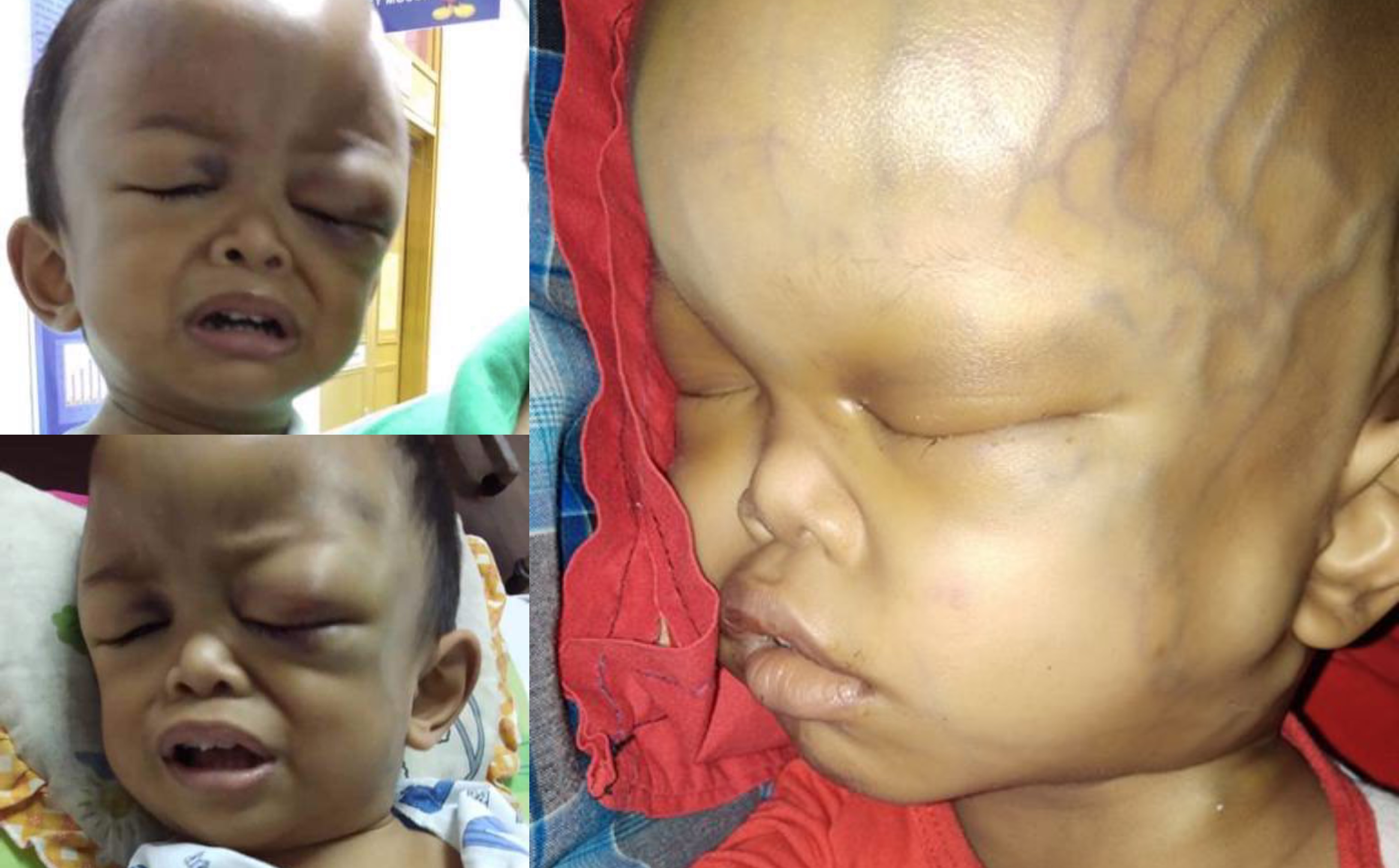 Kepala Terhantuk Pada Kerusi, Hampir 10 Bulan ‘Menderita’, Adik Iman Disahkan Meninggal Dunia