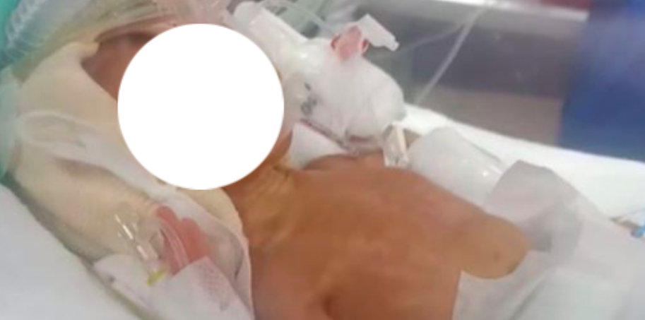‘Luruh Hati Tengok Wayar Berselirat Di Tubuh Adam’ – Ibu Kongsi Keadaan Bayi Lahir Pramatang