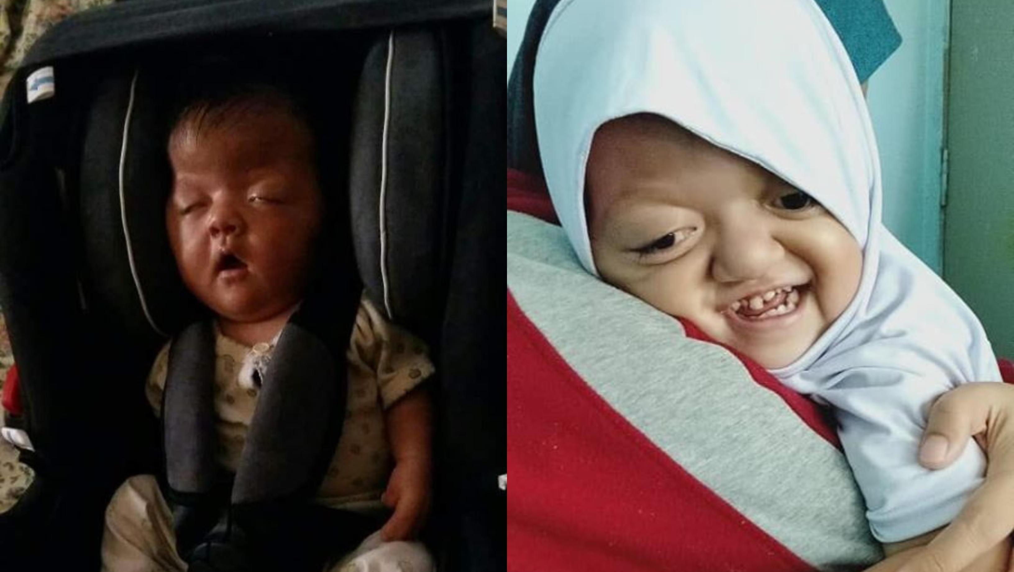 Jari Bercantum, Tempurung Kepala Tidak Normal, Kisah Adik Ardhania Raih Perhatian