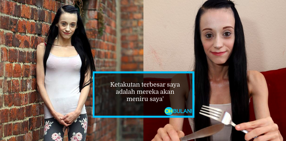 Wanita Hilang Lebih 30 Kg Cuma Makan Nugget Selama 4 Tahun