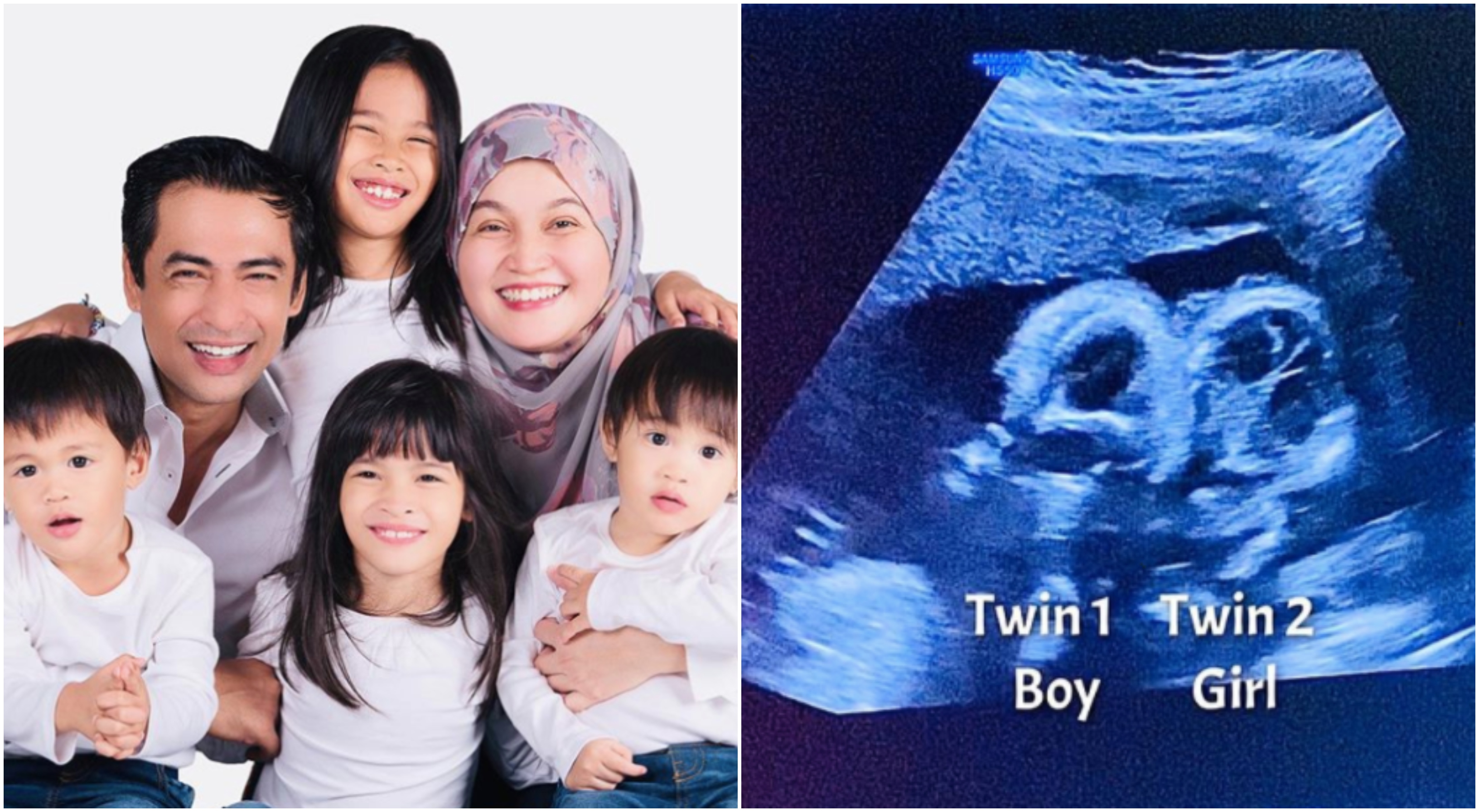 Kongsi Imbasan 3D, Dr Sheikh Muszaphar Bakal Timang Anak Kembar Lain Jantina Pula