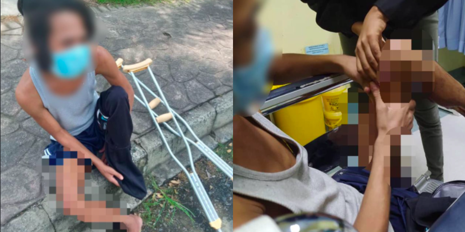 Luka Besar Sampai Nampak Tulang Betis, Lelaki Terpaksa Jalan Kaki Dari Kampung Ke Airport Kerana…