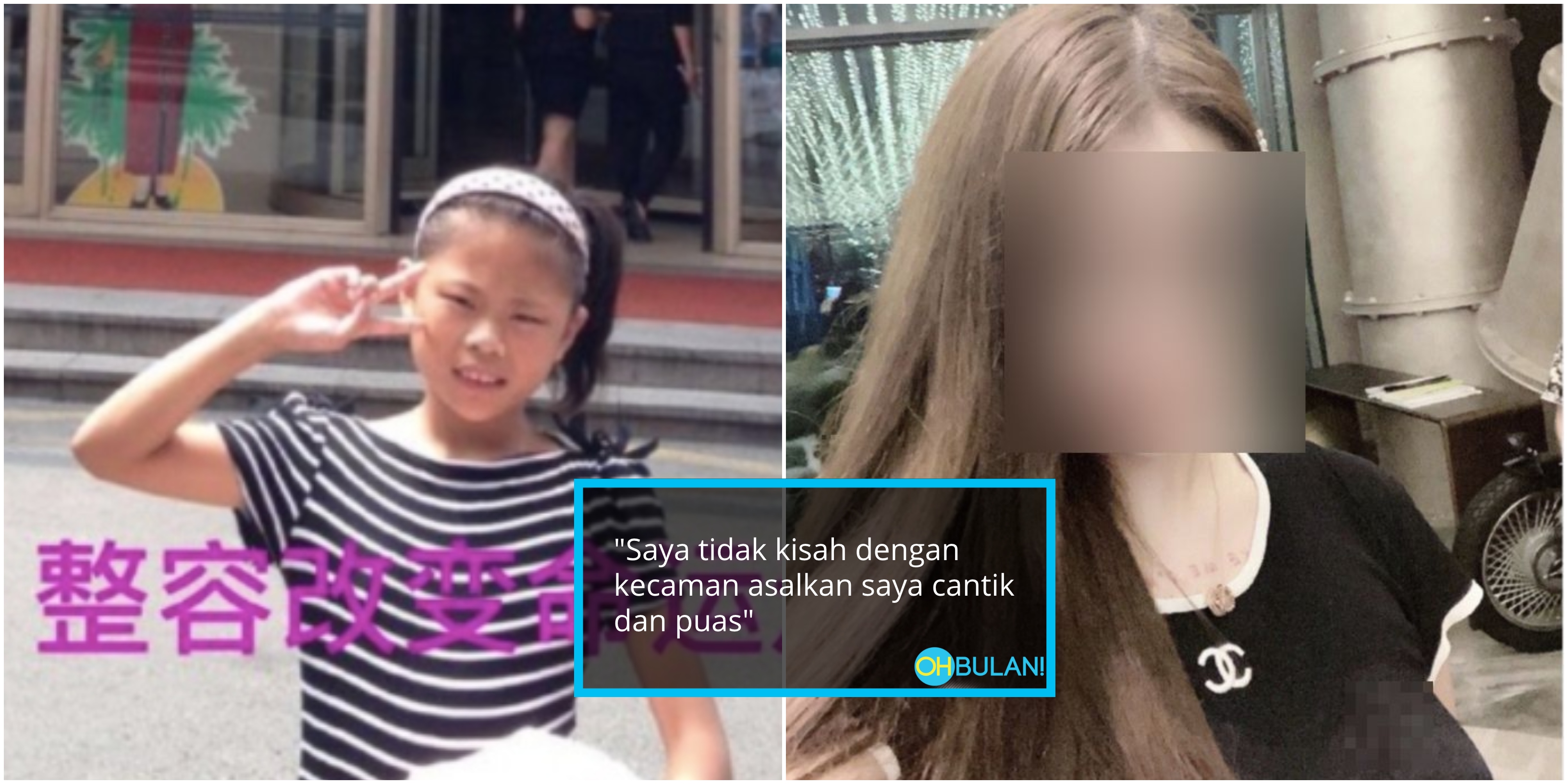 Demi Nak Cantik, ‘Influencer’ Sanggup Buat Pembedahan Plastik 60 Kali Tapi Hasilnya…