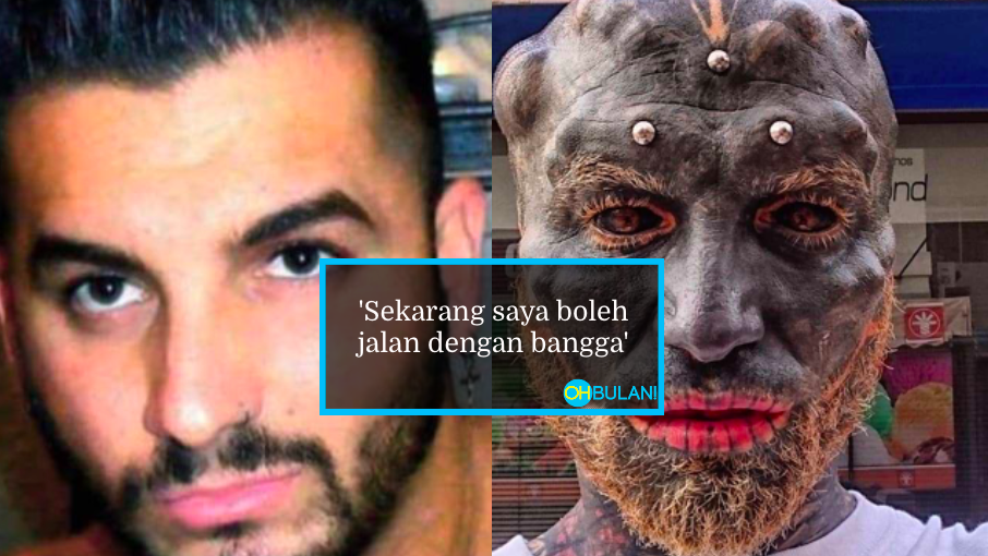 ‘Buang Hidung, Belah Lidah & Tatu Di Bola Mata’- Lelaki Ini Berkorban Demi ‘Wajah Idaman’
