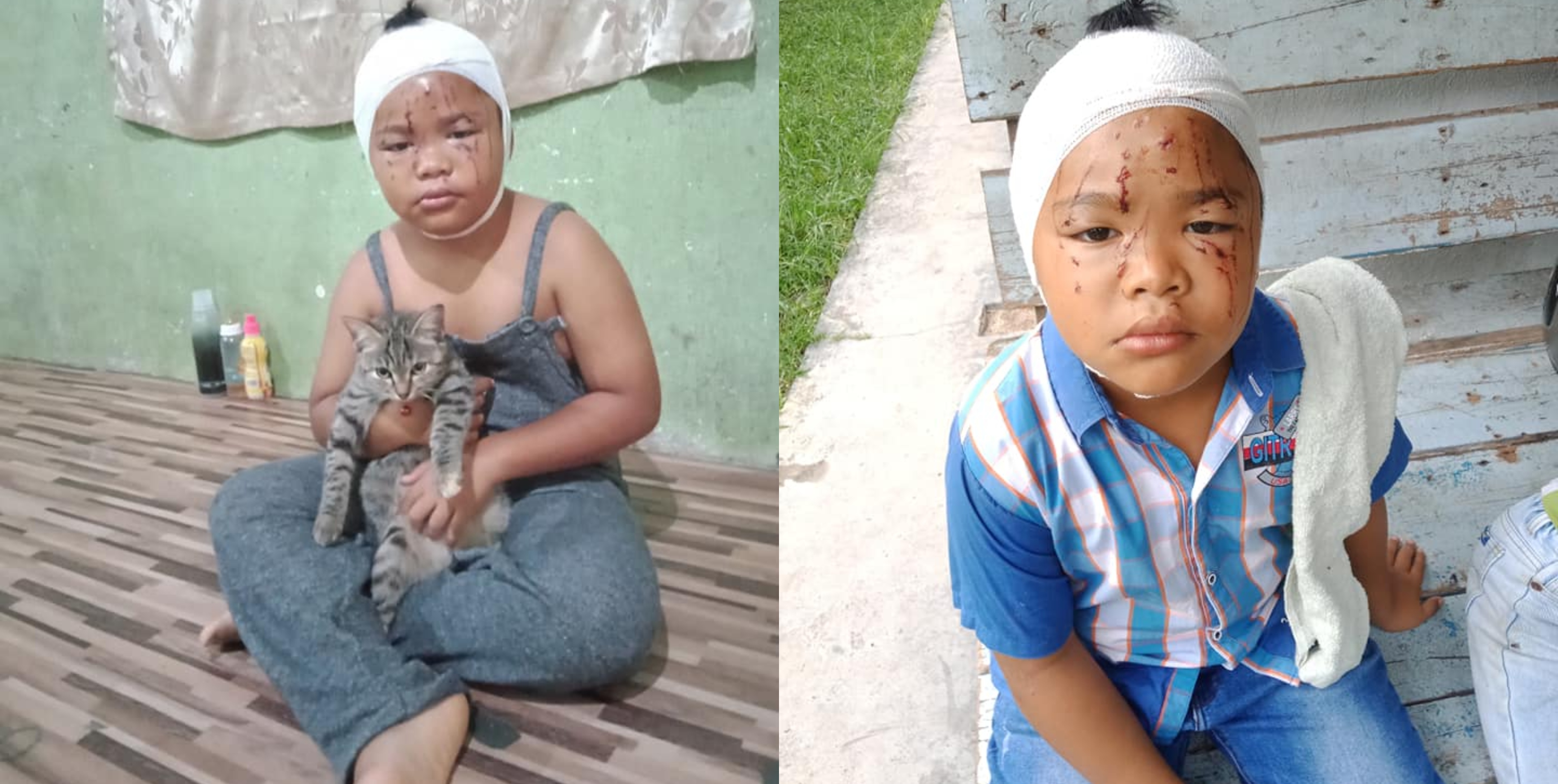 Teruk Kena Cakar Kucing