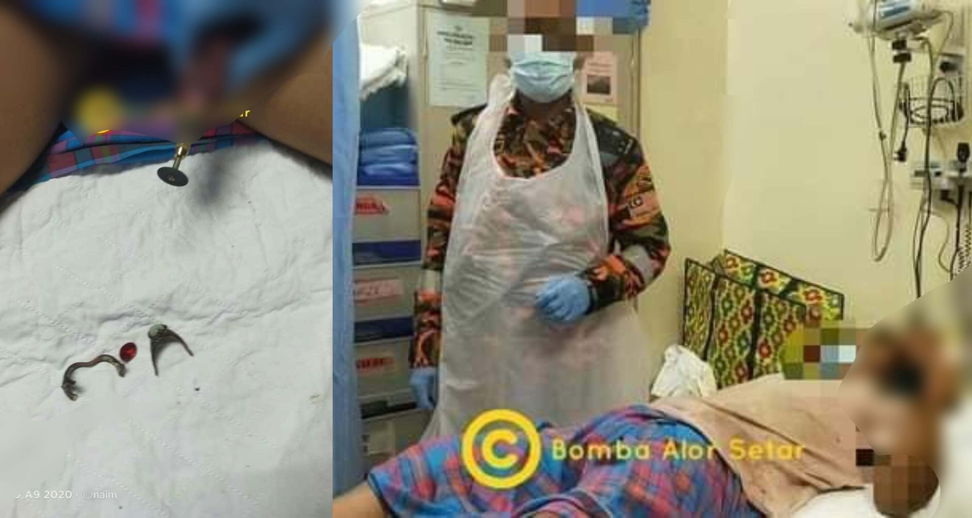 Tak Pasal-Pasal Bomba Kena Tolong Potong Cincin Dekat ‘Punai’ Paklong…