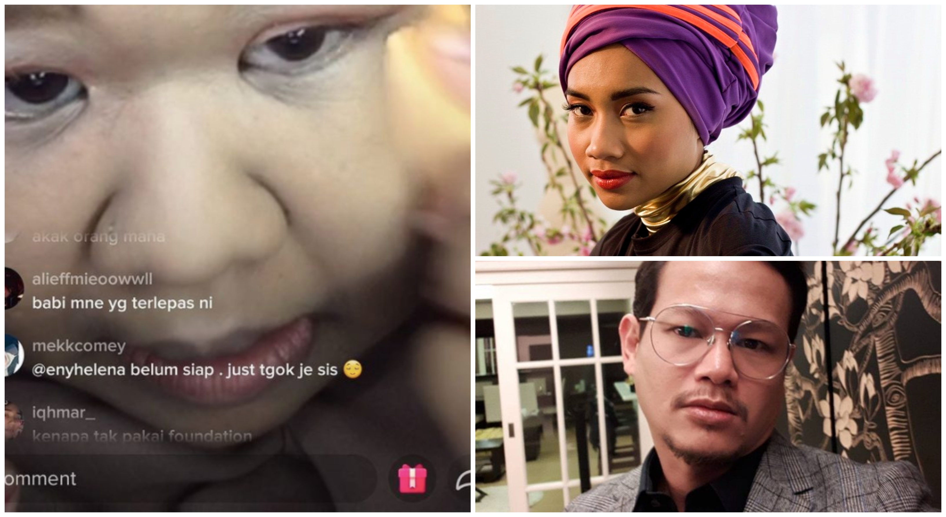 Teruk Kena ‘Face Shamming’ Waktu Live, Gadis Ini Terima Sokongan Dari Yuna & Que Haidar