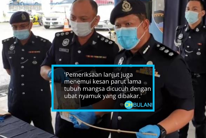 Kanak-Kanak 5 Lima Tahun Maut, Disepak & Ditendang Sampai Pecah Usus Oleh Nenek Saudara