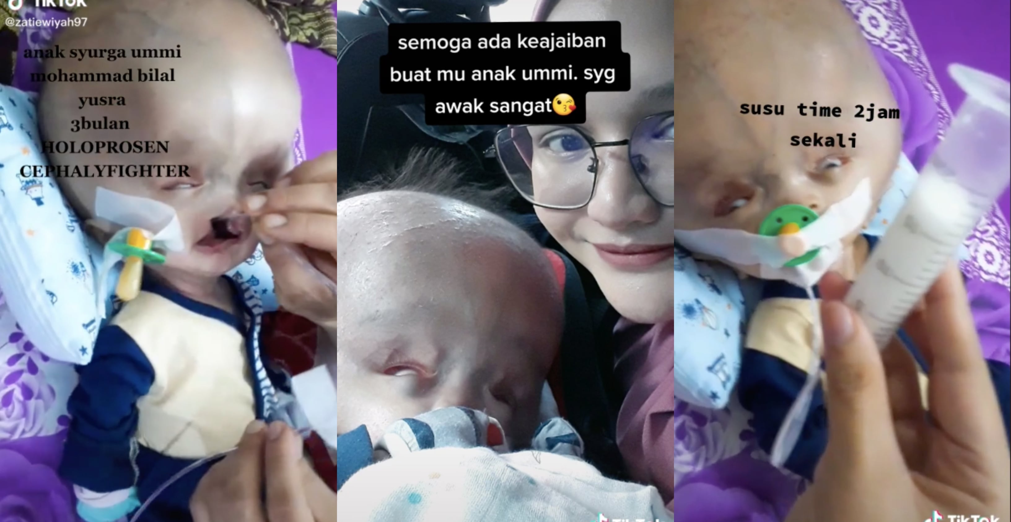 [VIDEO] ‘Semoga Ada Keajaiban Buat Anak Ummi’ – Ibu Tabah & Reda Besarkan Anak ‘Syurga’