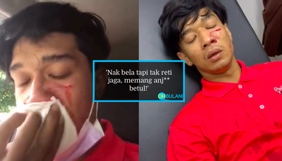 ‘Panasnya Muka Ya Allah’ – Pekerja Penghantar Barang Cedera Diserang Anjing Tuan Rumah