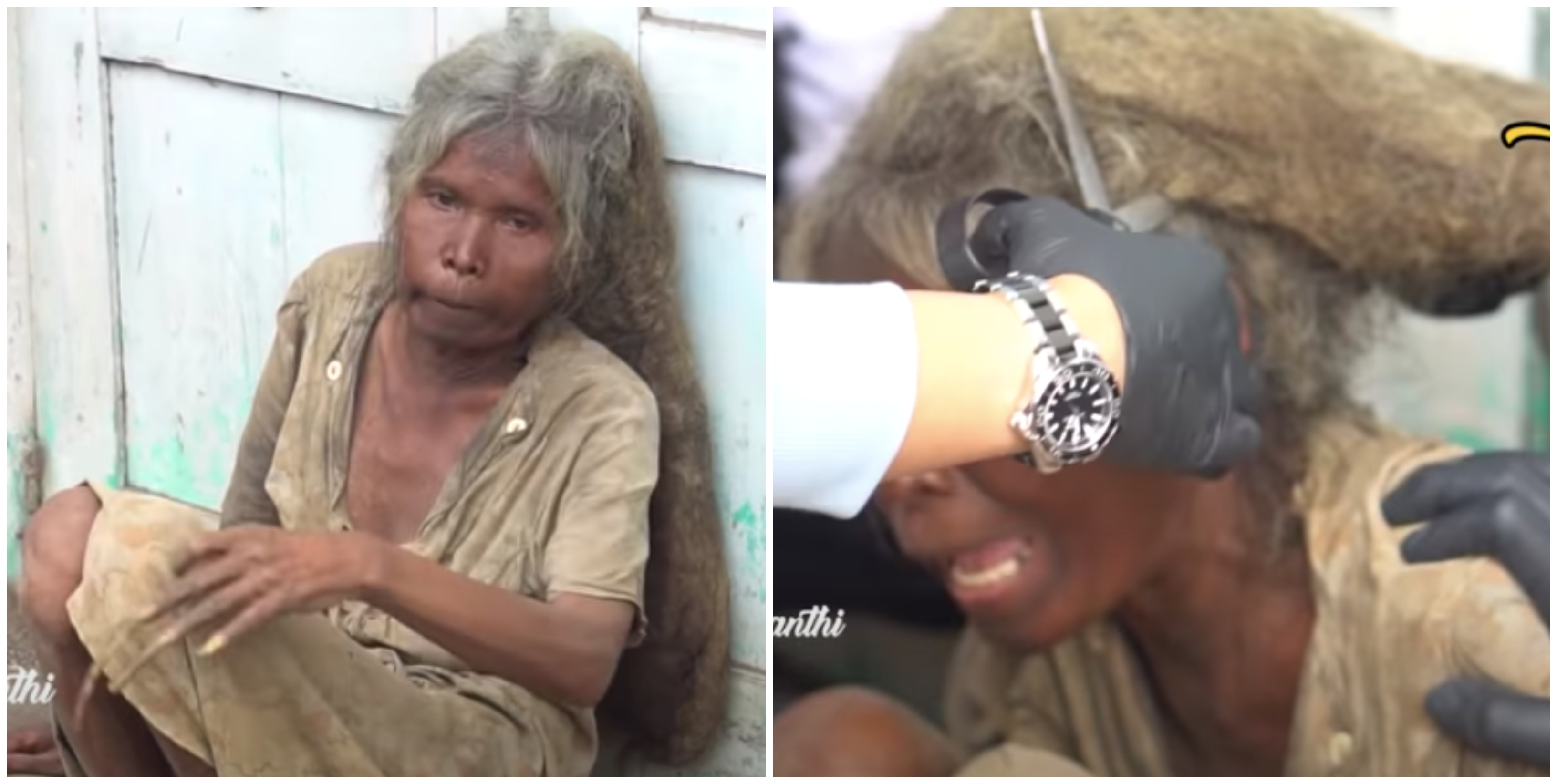 Berpuluh Tahun Tidak Pernah Potong Rambut & Kuku, Lihat Youtuber Indonesia Ini Lakukan Pada Gelandangan
