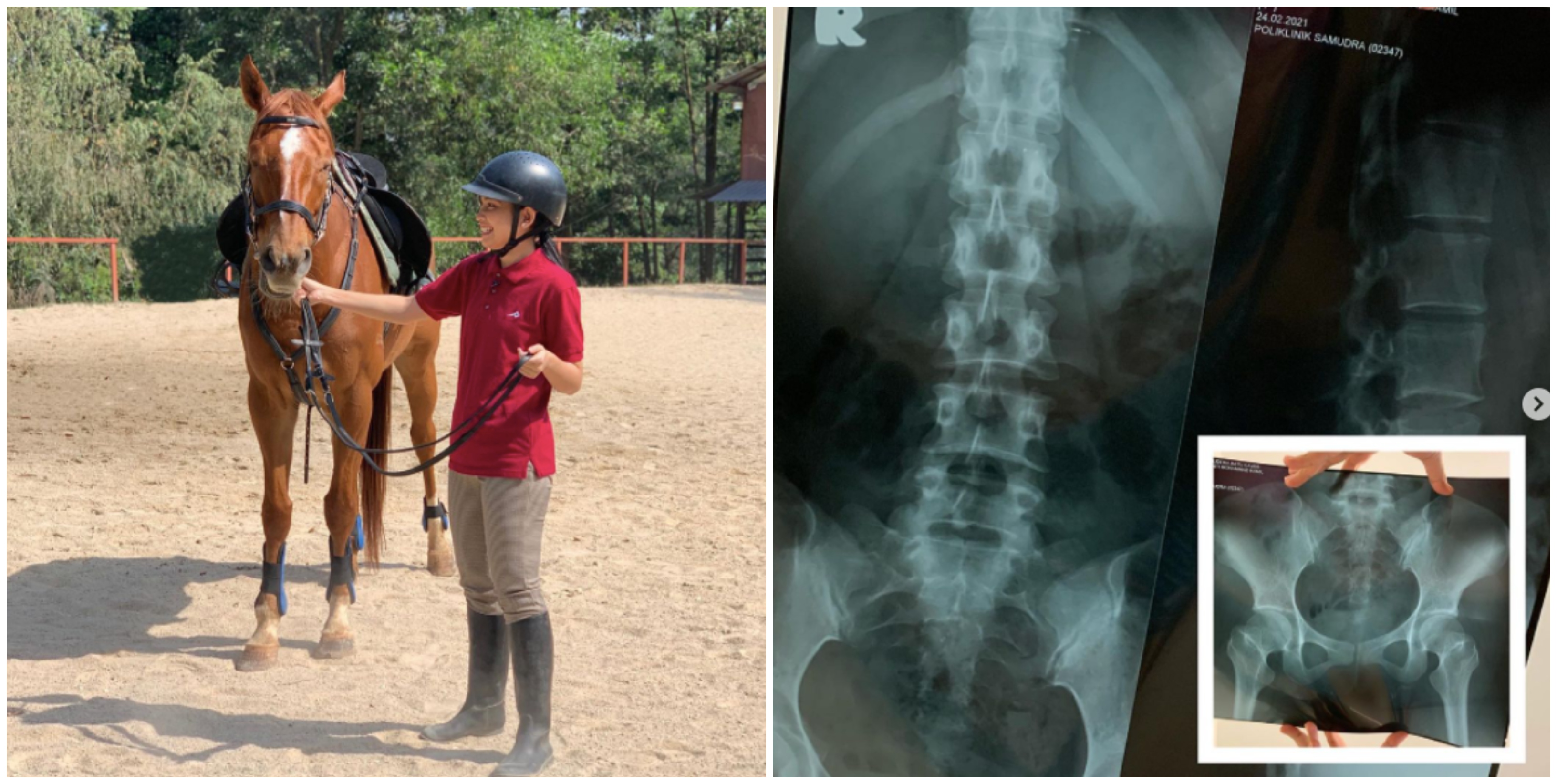 Sissy Iman Trauma Jatuh Naik Kuda