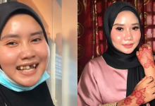 Gadis Dipuji, Walaupun Tiada 2 Batang Gigi Depan Tapi Tetap ‘Confident’ Kongsi Video