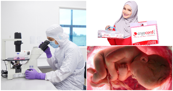 Simpan Darah Tali Pusat Untuk Lawan Penyakit Berbahaya, Siapa Kata Mahal?