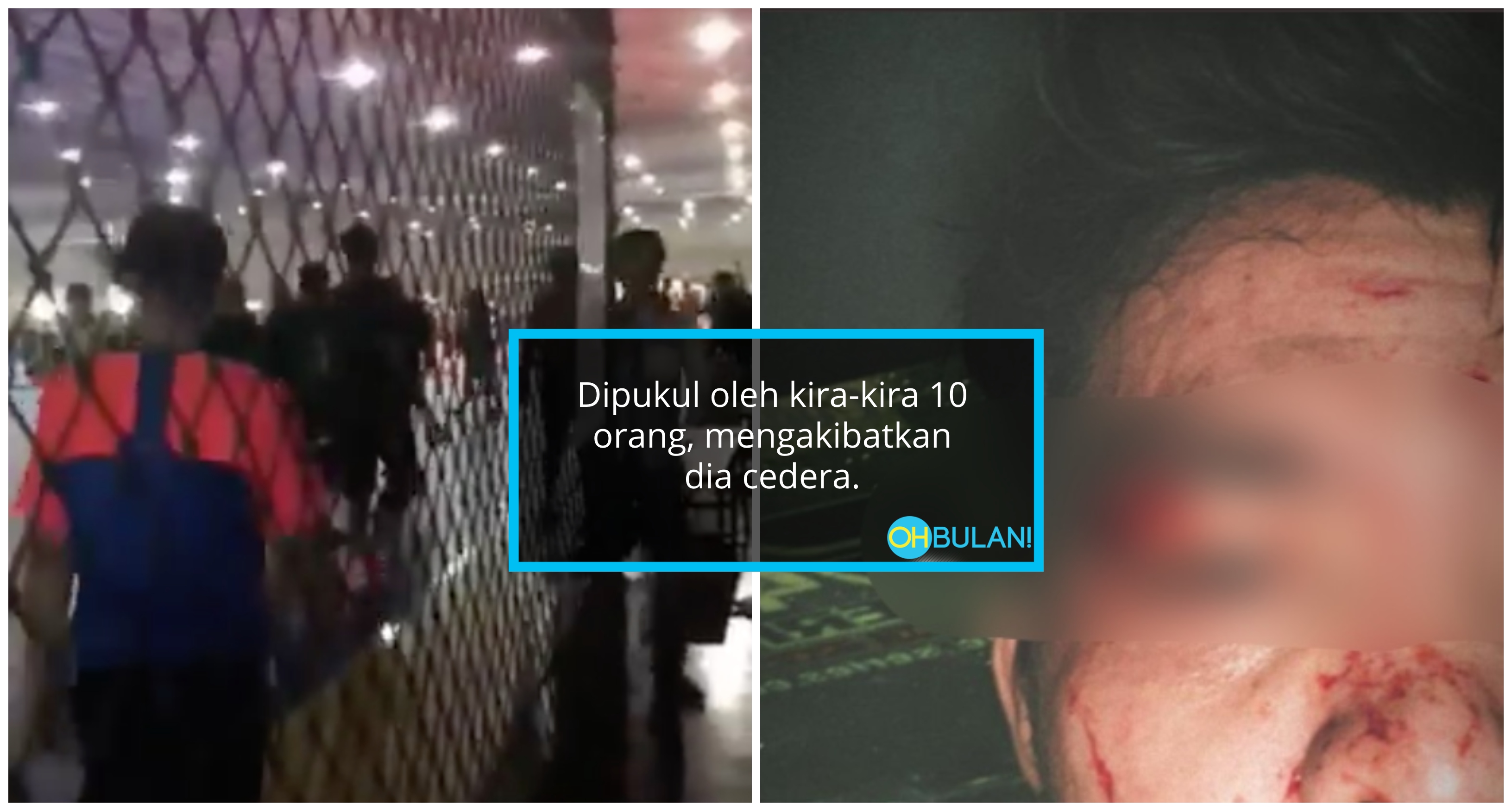 Mangsa Cedera Di Kening, Badan Calar. Polis Cari Geng Youtuber Bergaduh Di Court Futsal