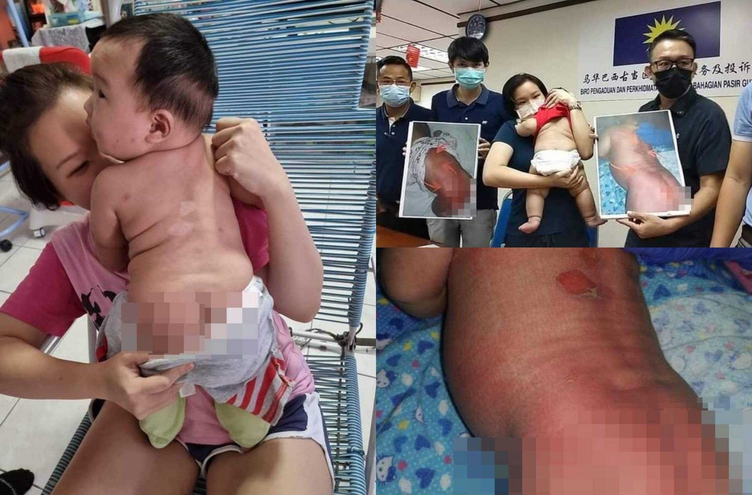 Bayi Melecur Dimandikan Air Panas, Pusat Jagaan Cuba ‘Settle Tepi’ Bayar RM45k Tapi…