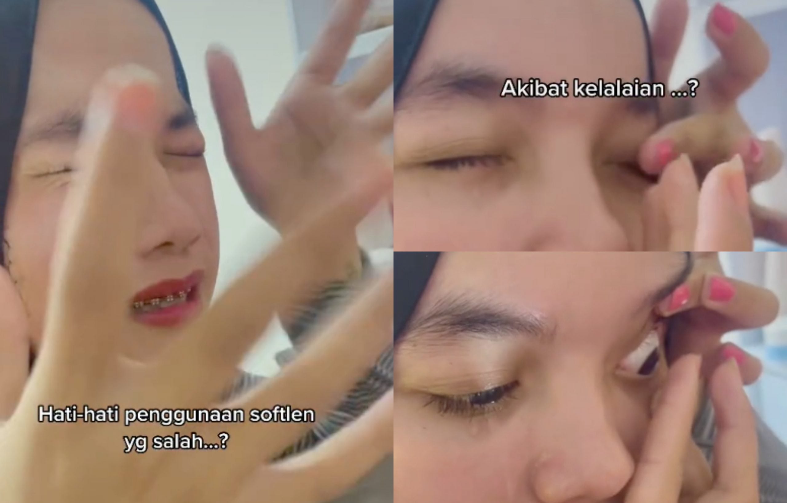 [VIDEO]  Tertidur 3 Jam Pakai Contact Lens, Gadis Panik Contact Lens Melekat Di Bola Mata Lebih 7 Jam… Ngeri!
