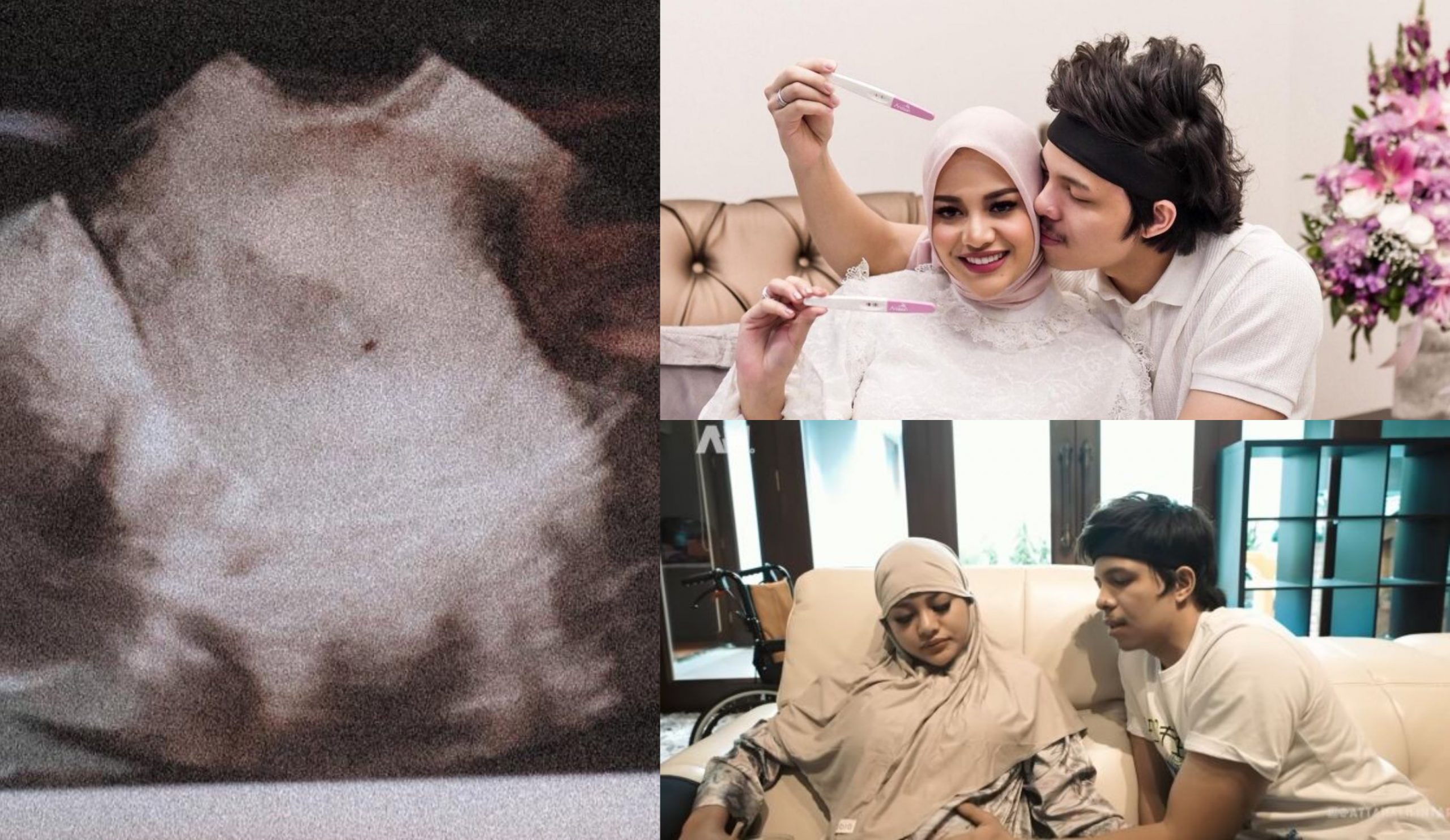 Berlaku Pendarahan & Ada Benda Berwarna Coklat Keluar, Aurel Hermansyah Kongsi Detik Alami Keguguran