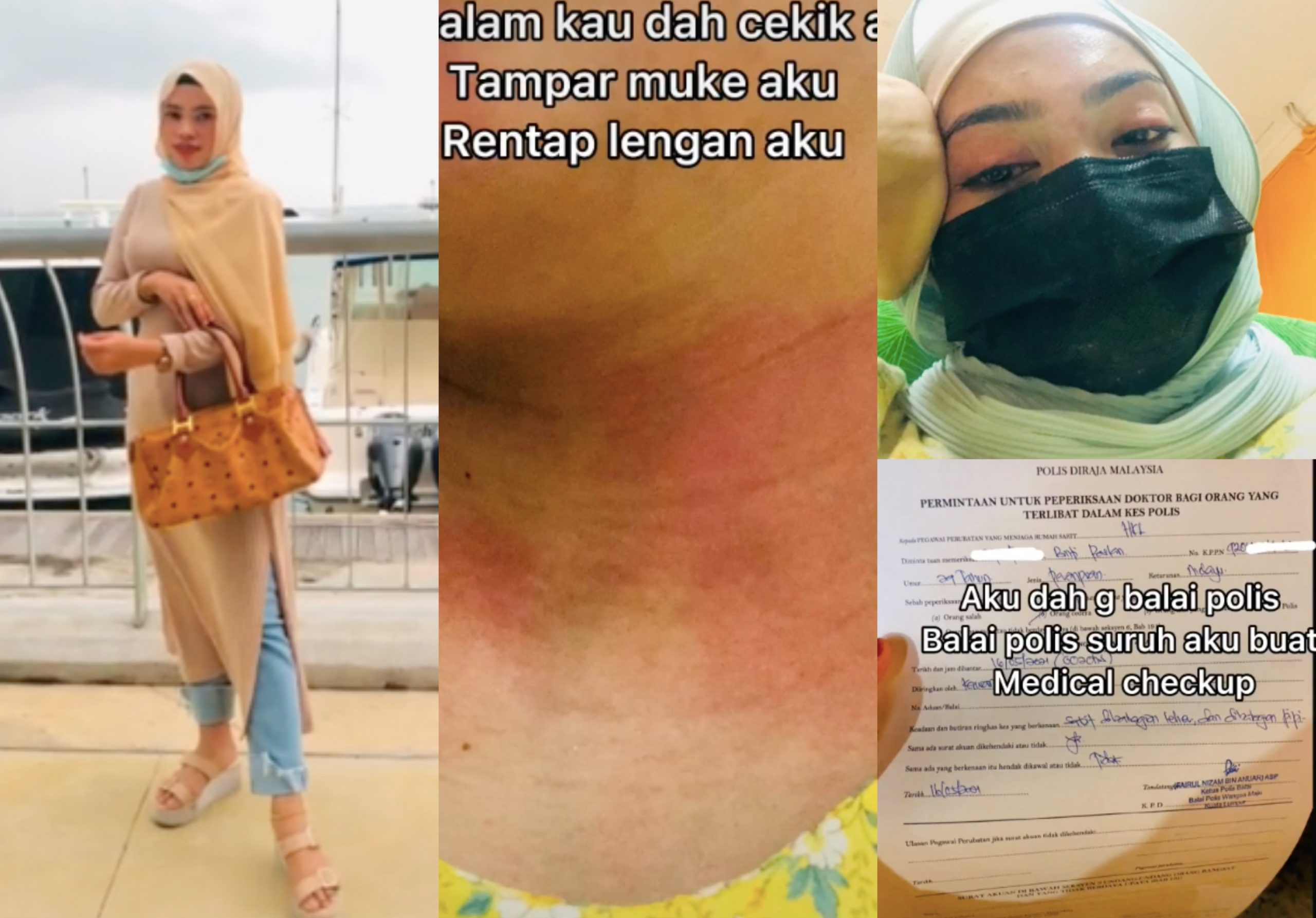 Gadis Lapor Polis Ditampar, Dicekik Bekas Kekasih Gila Tak ‘Move On’