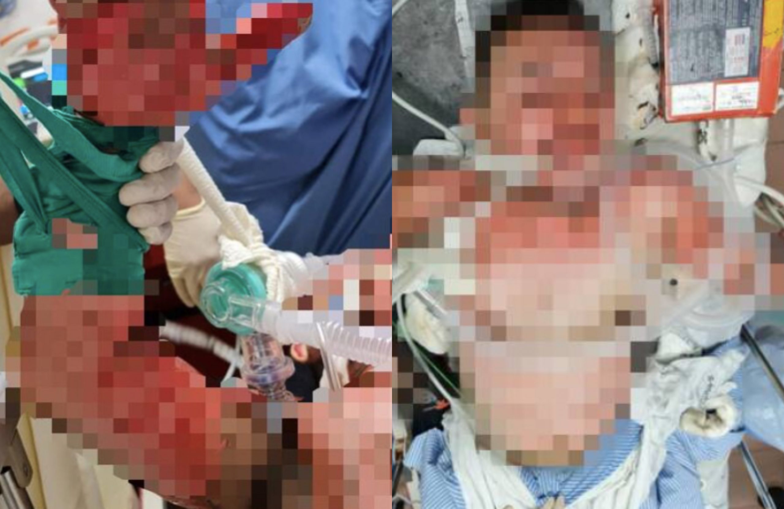 Tak Puas Hati Kereta Dibaiki Masih Rosak, Individu Tergamak Bakar Mekanik Sampai Masuk ICU