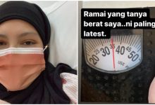 Berat Badan Makin Susut Cuma 35kg, Elyana Bakal Jalani Rawatan Radioterapi 10 Hari