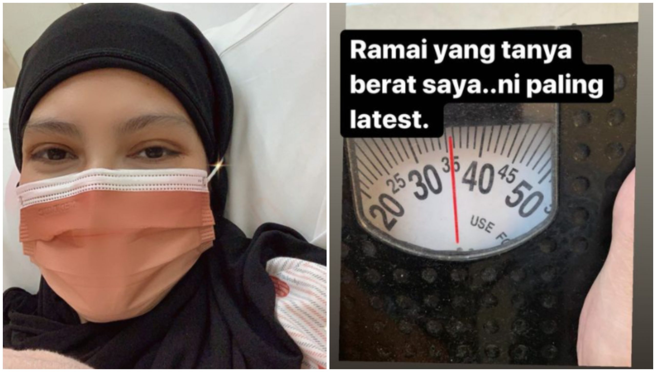Berat Badan Makin Susut Cuma 35kg, Elyana Bakal Jalani Rawatan Radioterapi 10 Hari