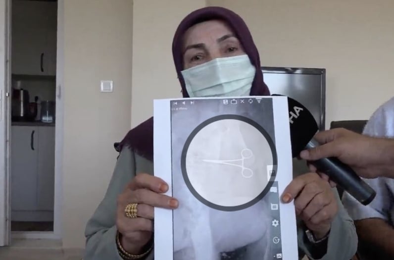 2 Bulan ‘Sakit Perut’, Doktor Kata Perkara Biasa Selepas Pembedahan. Bila Scan Semula Rupa-Rupanya Ada…