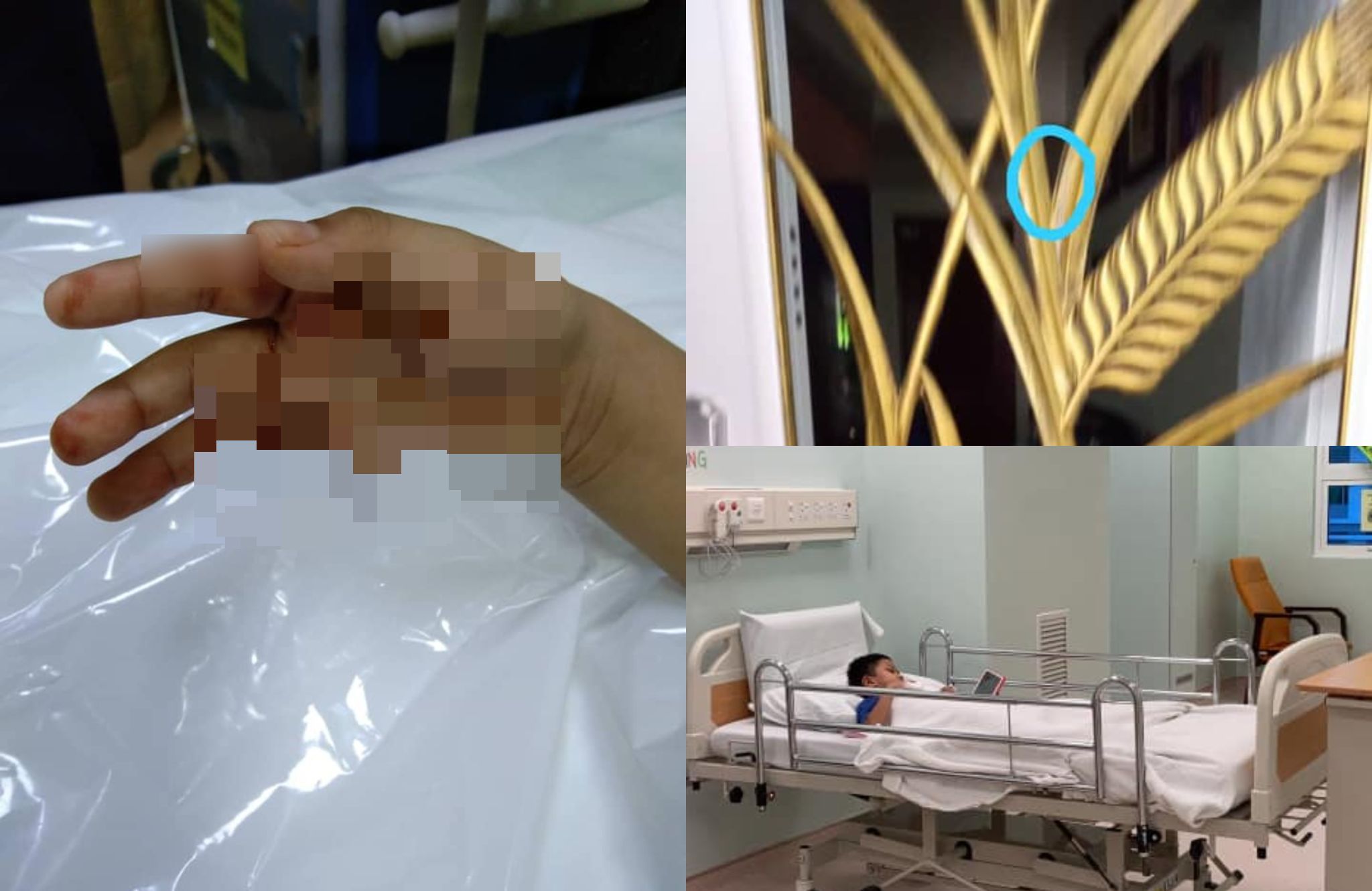 Jari Kanak-Kanak Terputus, ‘Tersangkut’ Di Pintu Besi Masa Main Panjat-Panjat