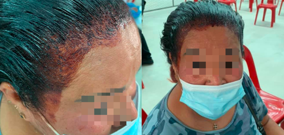 Petugas Syak Wanita Didera Sebab Kepala ‘Berlumuran Darah’ Pergi PPV, Rupanya…