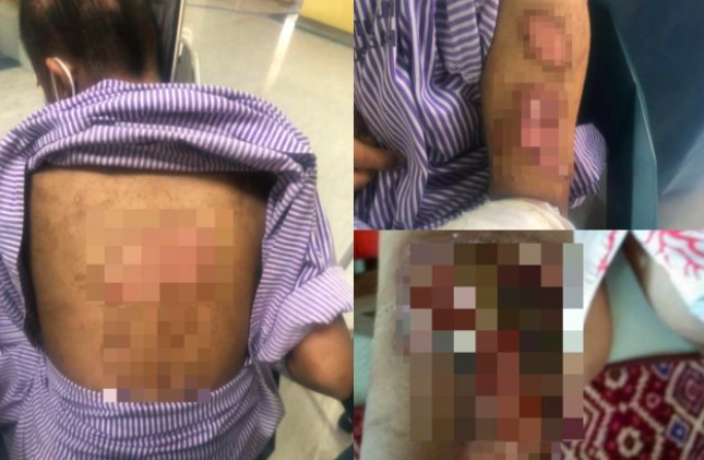 Pemilik Rumah Bonda Ditahan Polis Bantu Siasatan Kes Penderaan Adik Bella