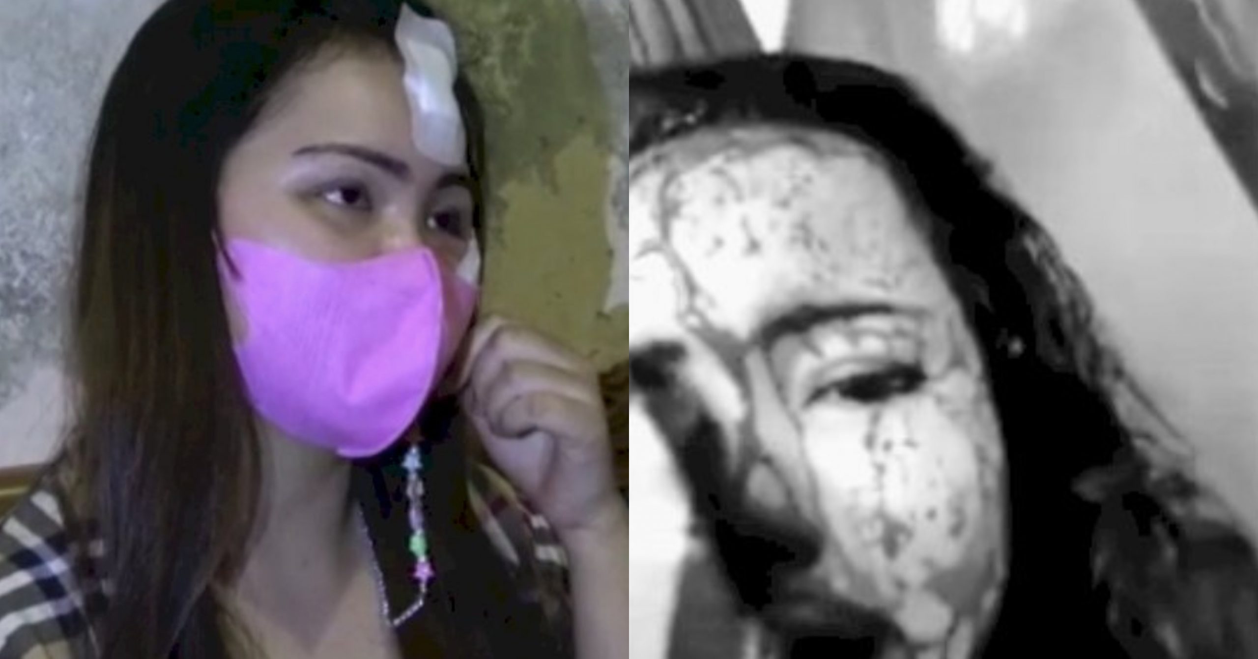 Muka Berlumuran Darah Dipukul Suami, Wanita Sempat Buat ‘Live’ Minta Bantuan