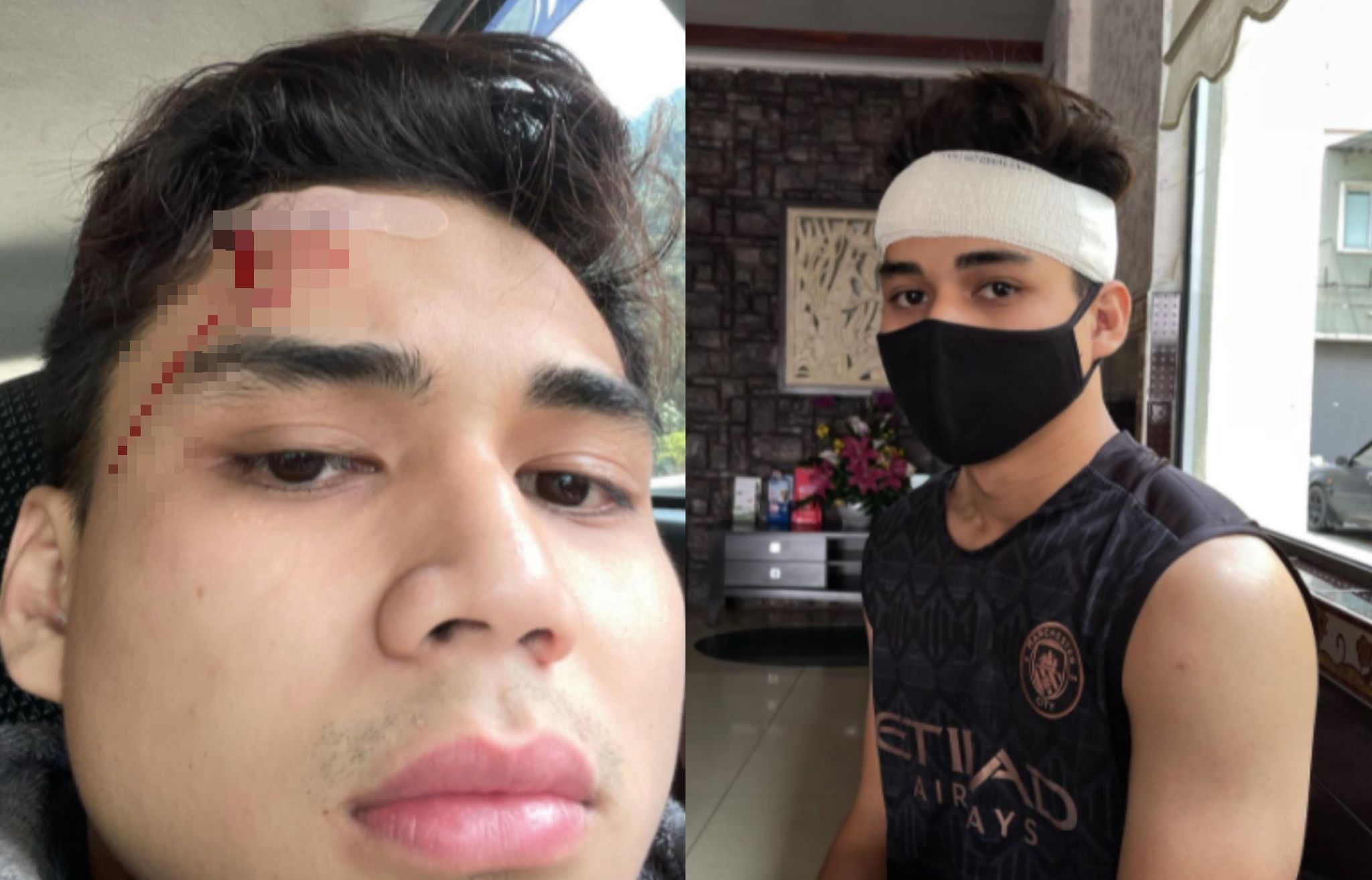 Dahi Luka Sampai Kena Jahit, Raja Atiq Terlibat Tragedi Mandi Sungai